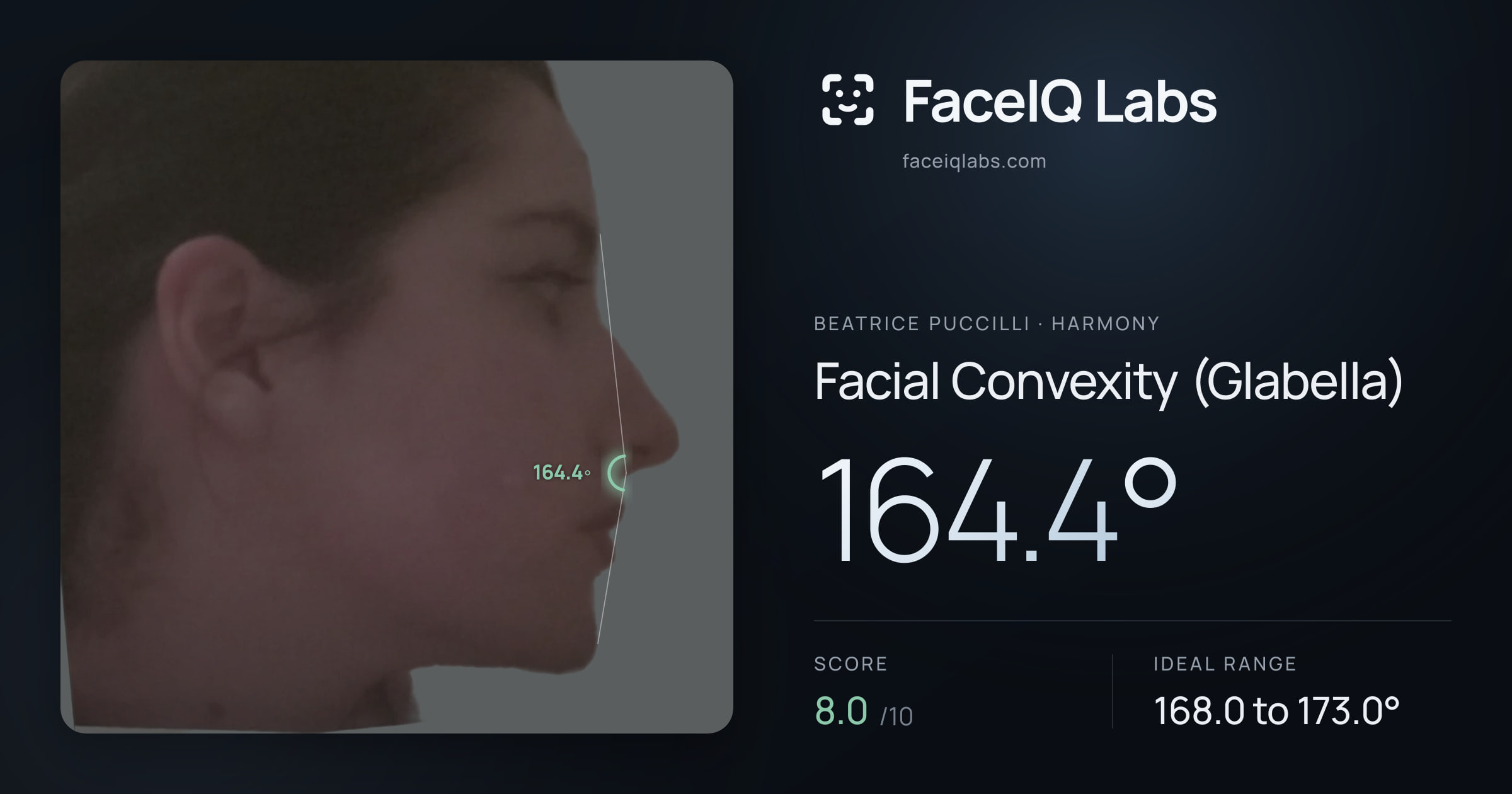 Beatrice Puccilli Facial Convexity (Glabella): 164.4°, drawn on the photo