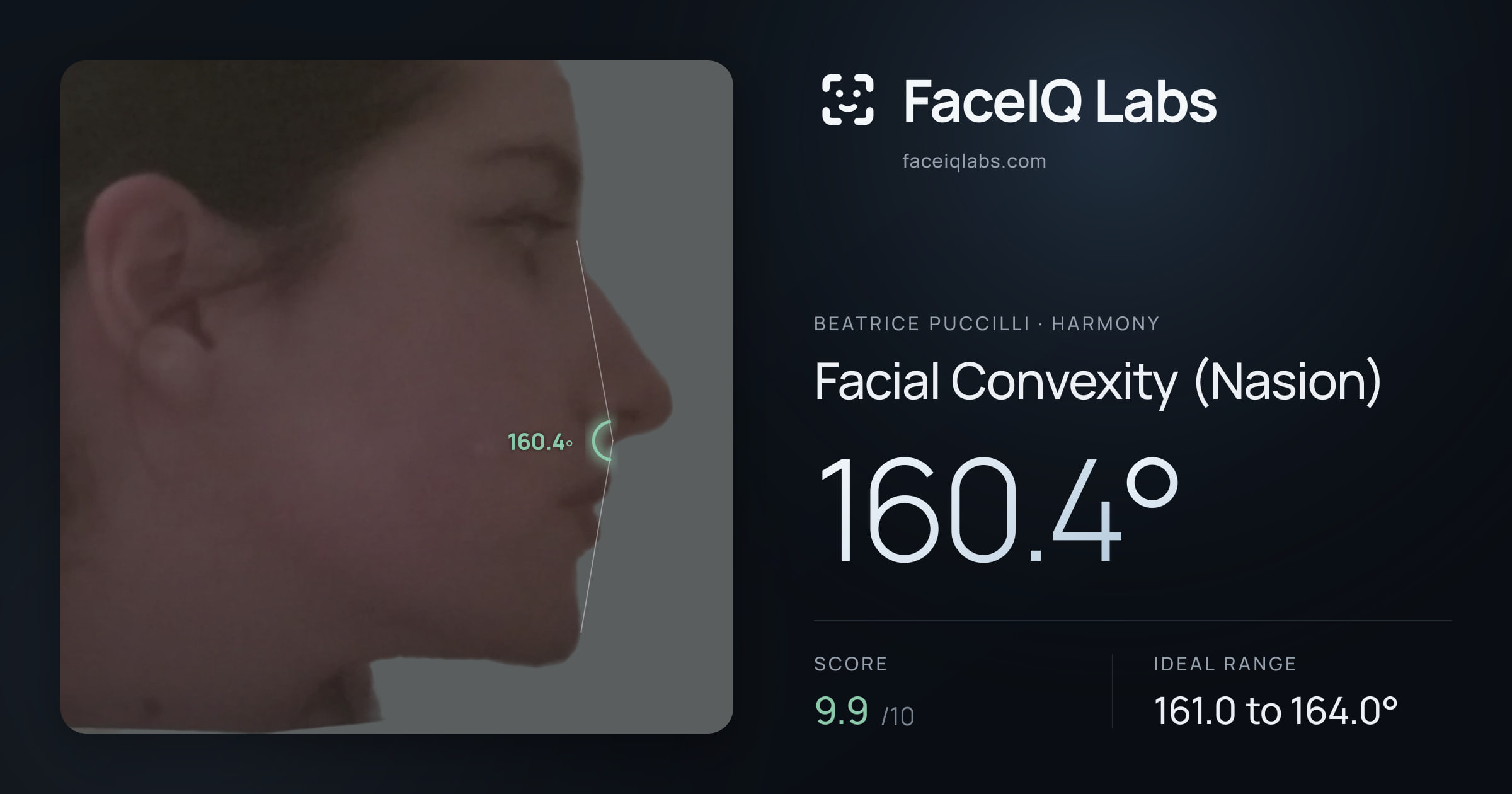 Beatrice Puccilli Facial Convexity (Nasion): 160.4°, drawn on the photo