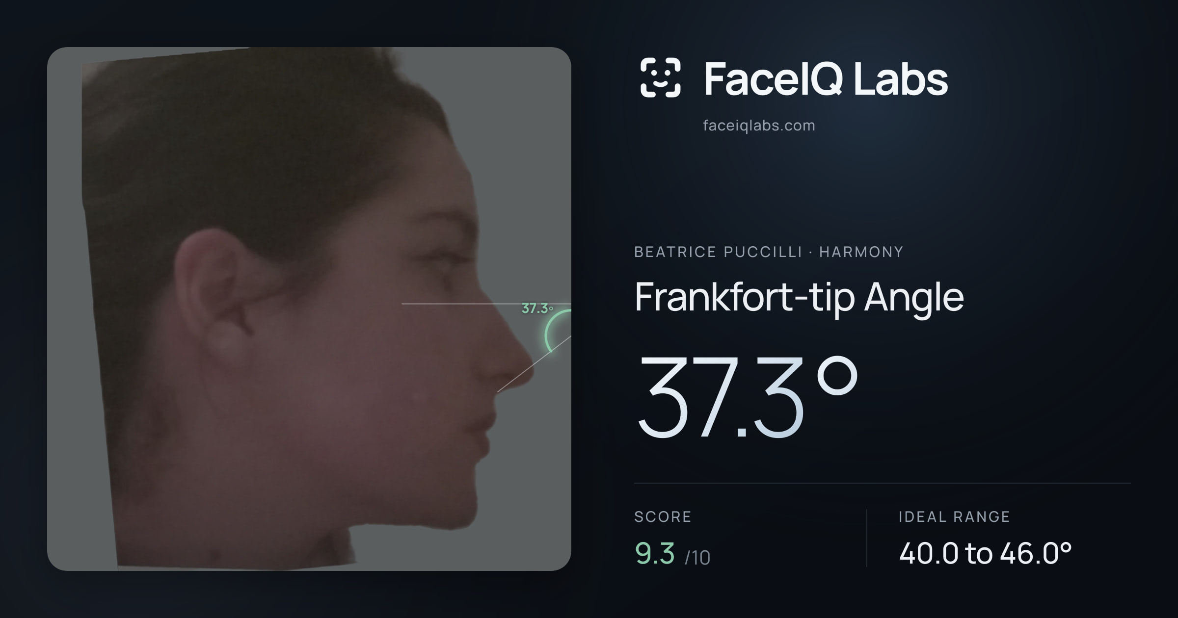 Beatrice Puccilli Frankfort-tip Angle: 37.3°, drawn on the photo