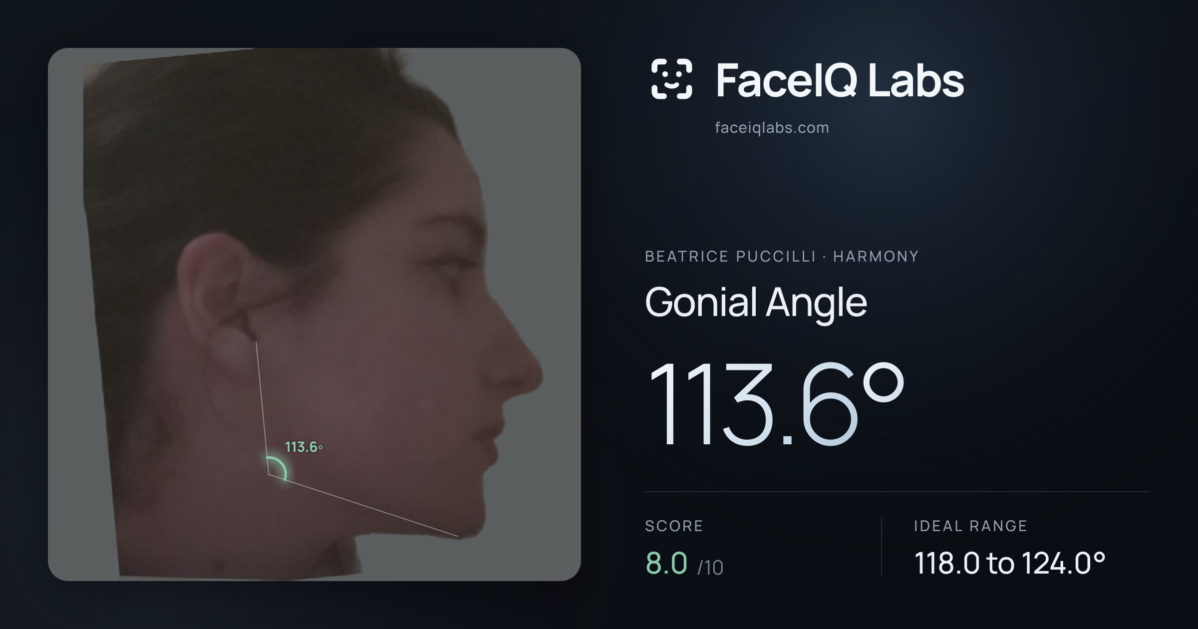 Beatrice Puccilli Gonial Angle: 113.6°, drawn on the photo
