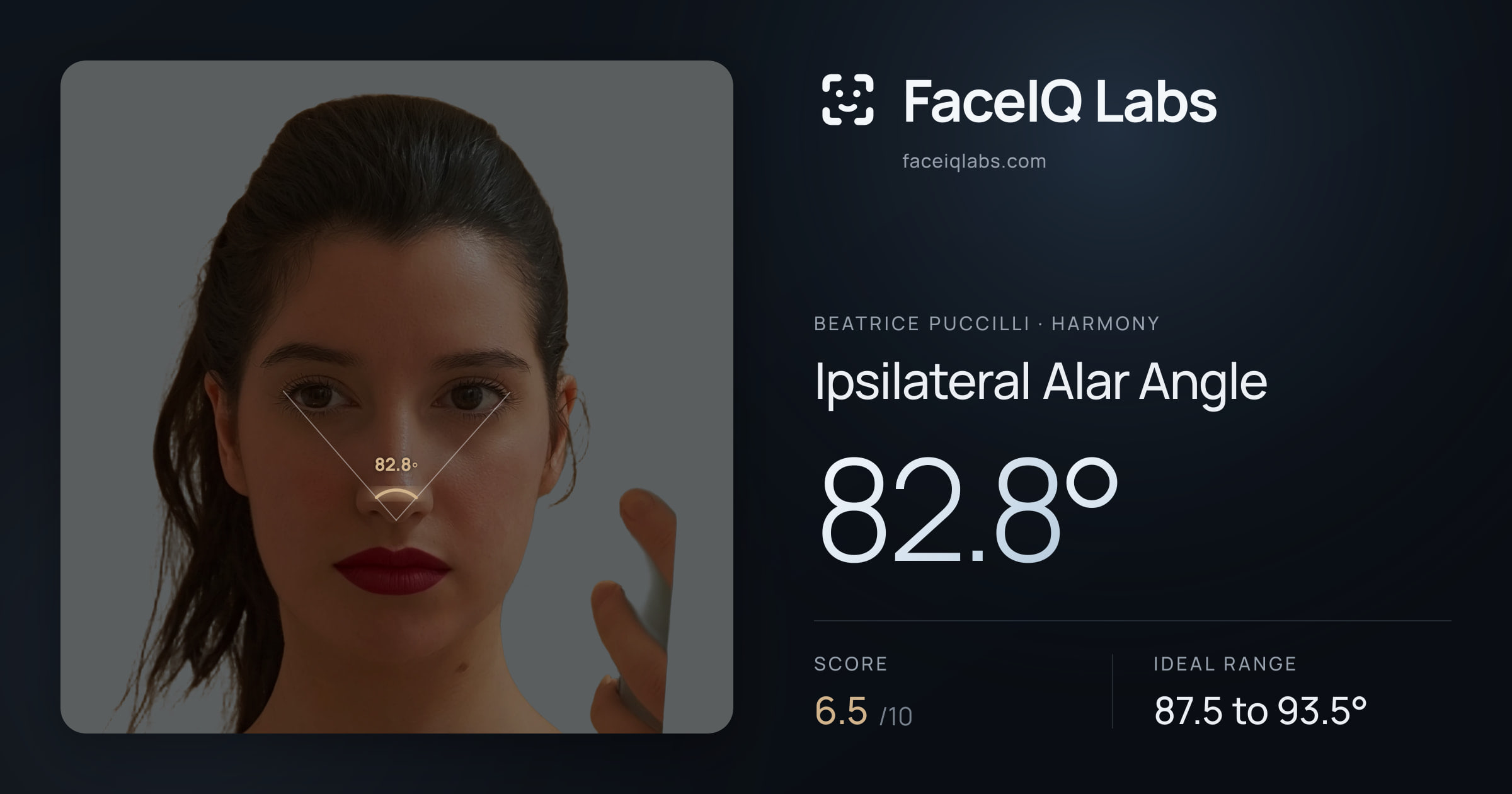 Beatrice Puccilli Ipsilateral Alar Angle: 82.8°, drawn on the photo