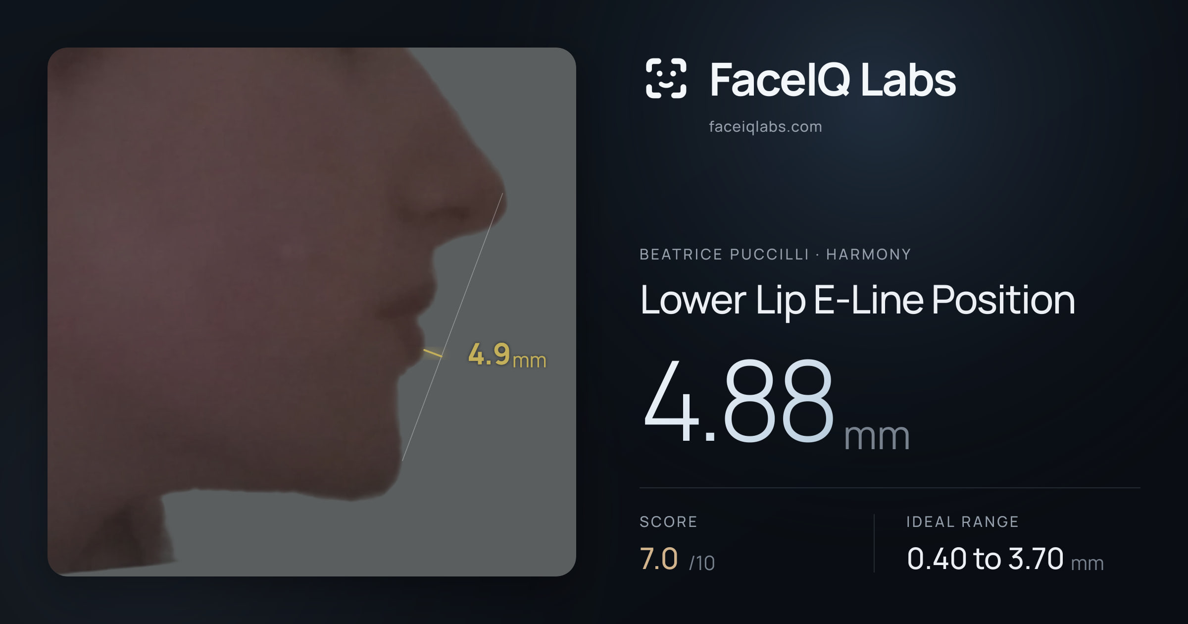 Beatrice Puccilli Lower Lip E-Line Position: 4.88mm, drawn on the photo