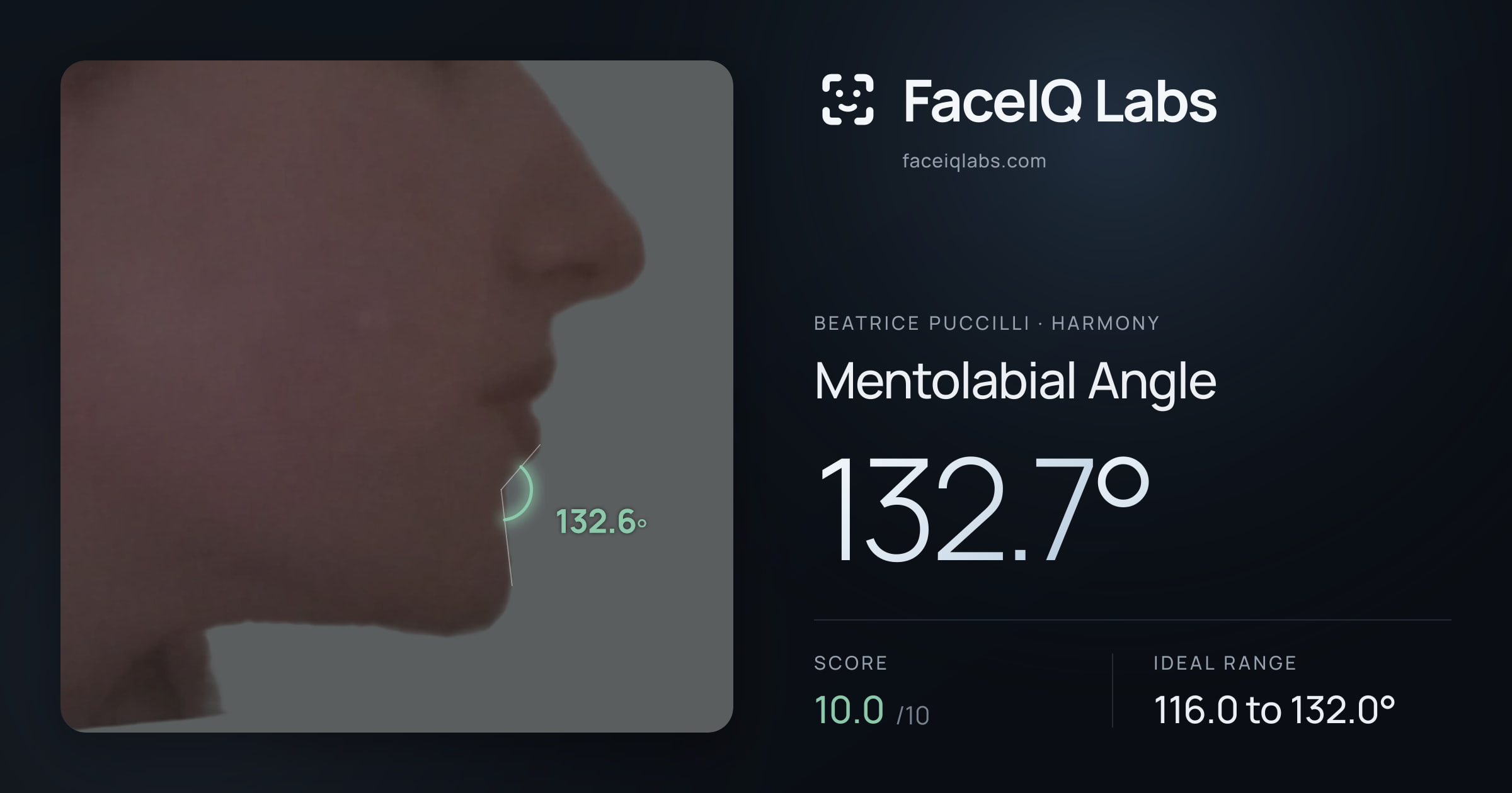 Beatrice Puccilli Mentolabial Angle: 132.7°, drawn on the photo