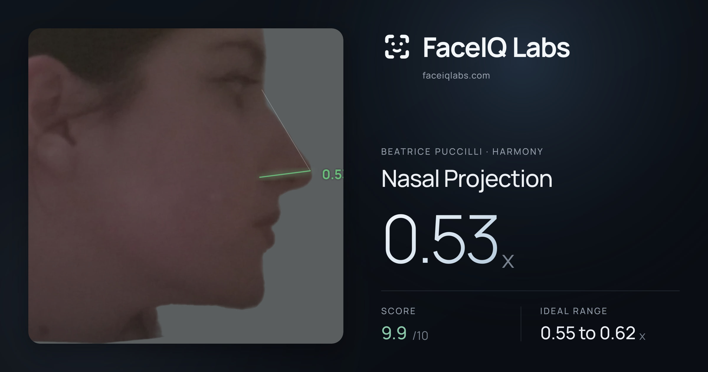 Beatrice Puccilli Nasal Projection: 0.53x, drawn on the photo