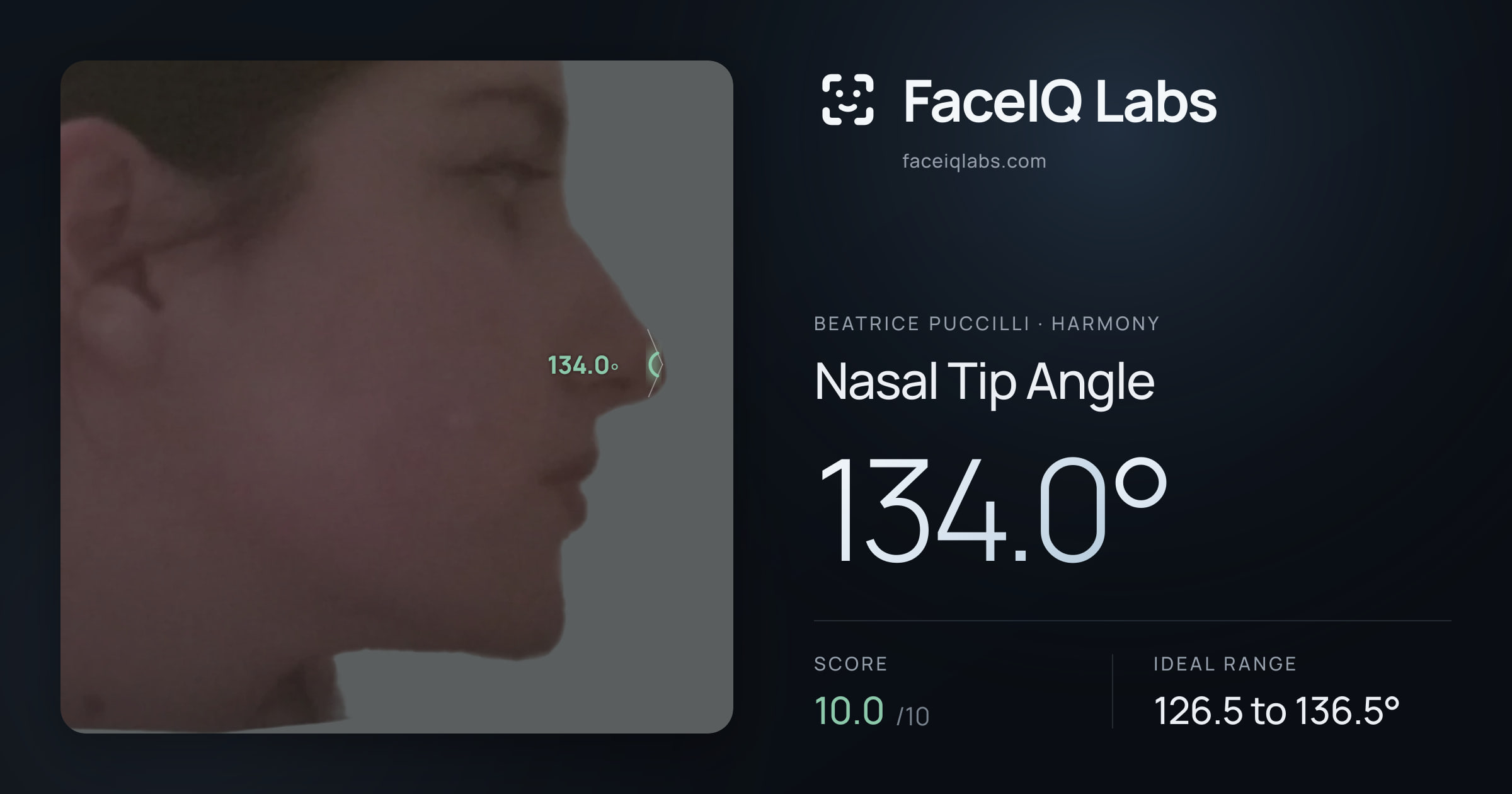 Beatrice Puccilli Nasal Tip Angle: 134.0°, drawn on the photo