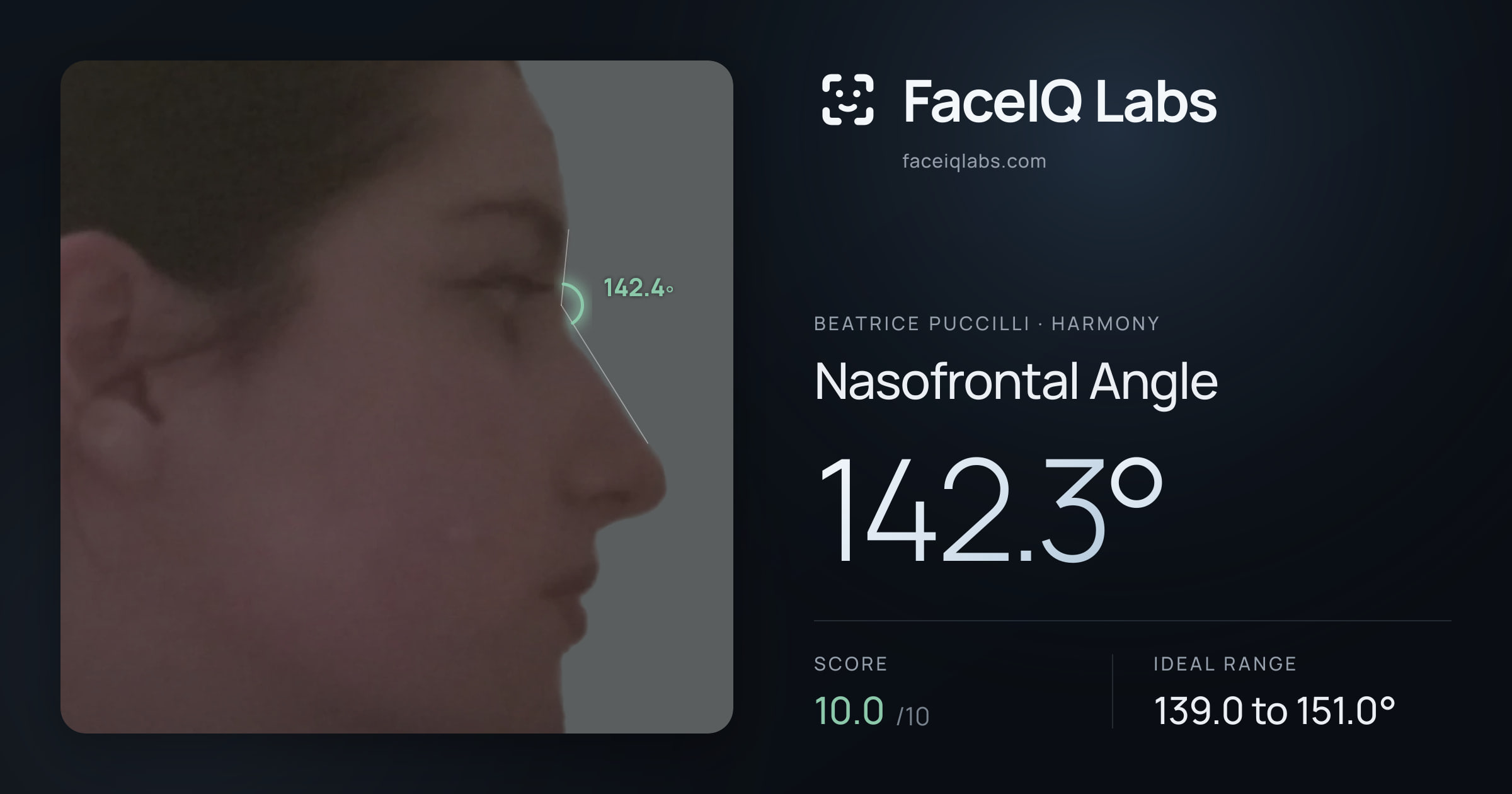 Beatrice Puccilli Nasofrontal Angle: 142.3°, drawn on the photo