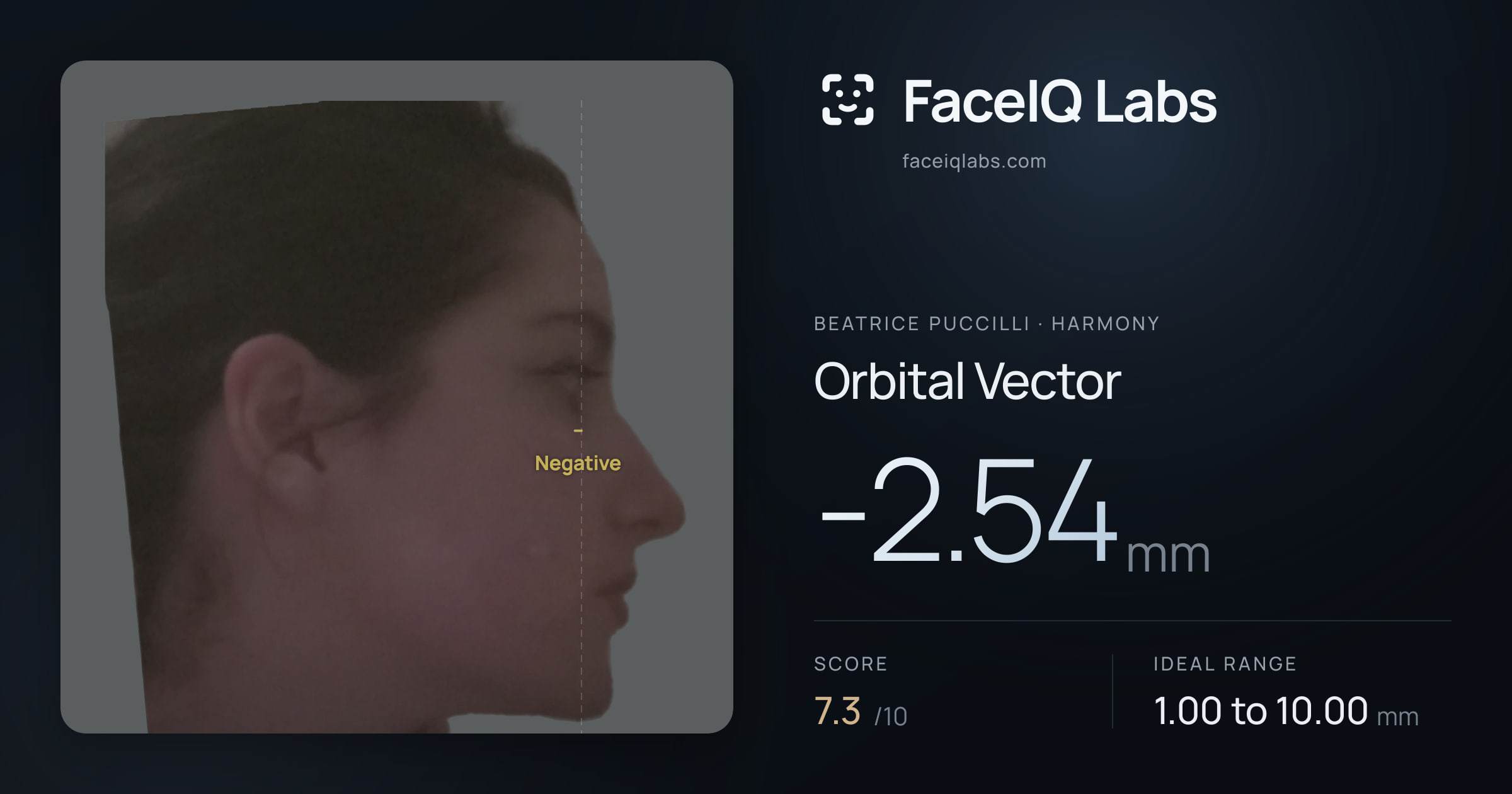Beatrice Puccilli Orbital Vector: -2.54mm, drawn on the photo