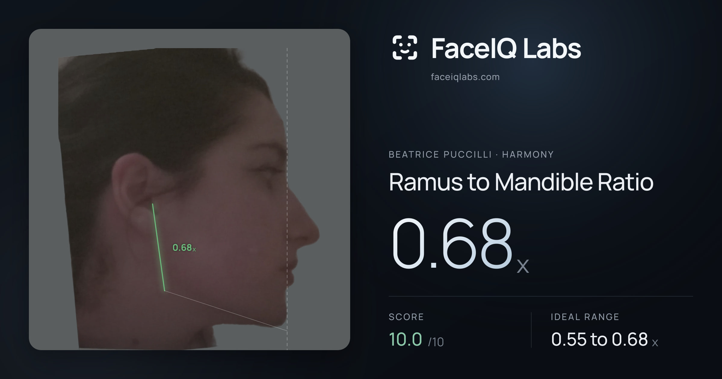 Beatrice Puccilli Ramus to Mandible Ratio: 0.68x, drawn on the photo