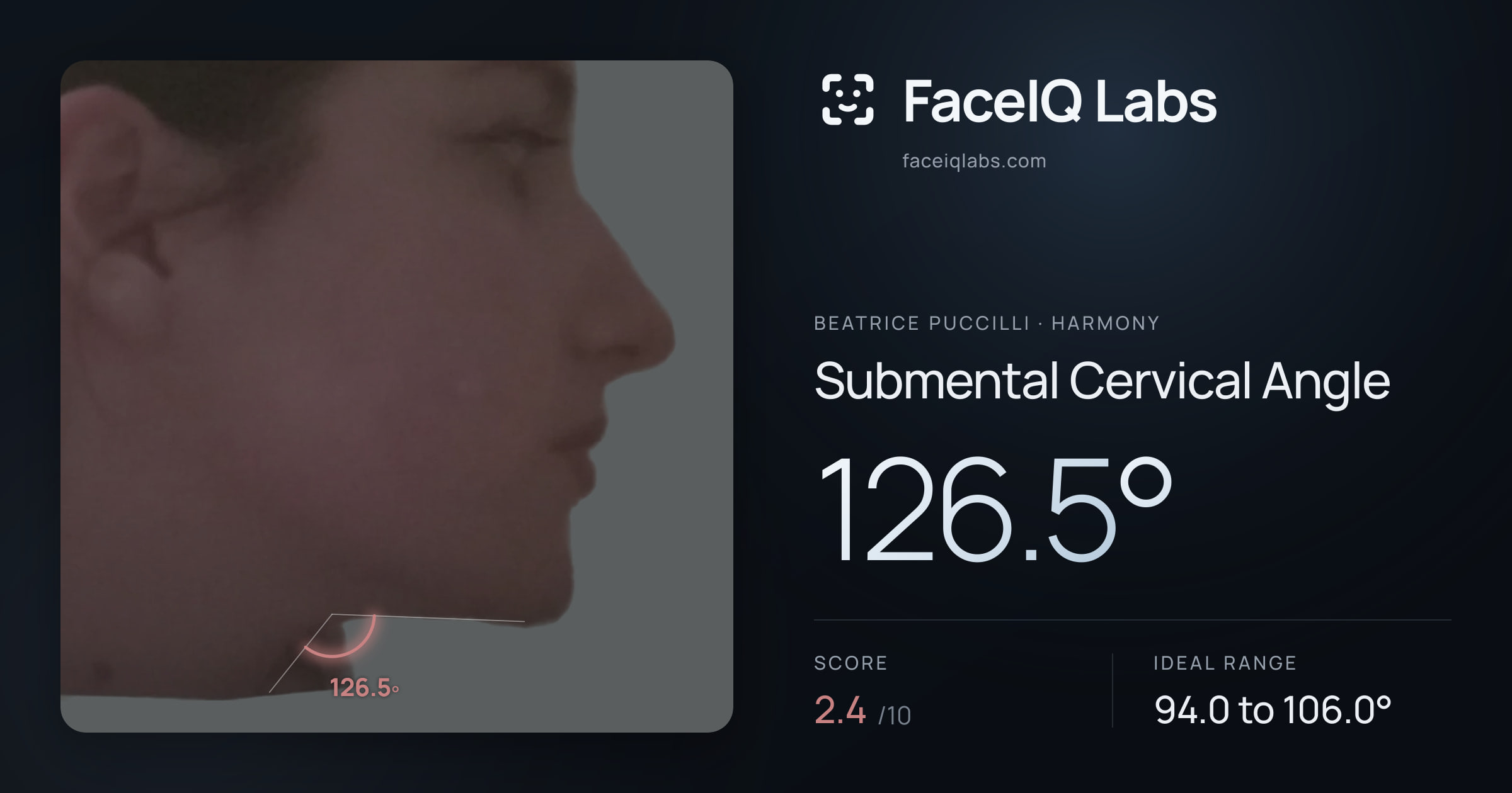 Beatrice Puccilli Submental Cervical Angle: 126.5°, drawn on the photo