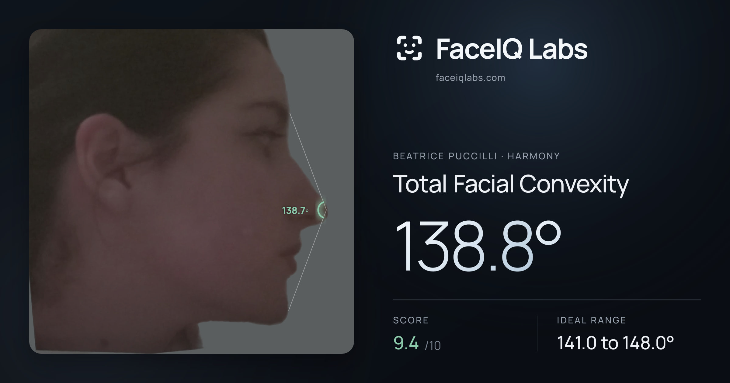 Beatrice Puccilli Total Facial Convexity: 138.8°, drawn on the photo