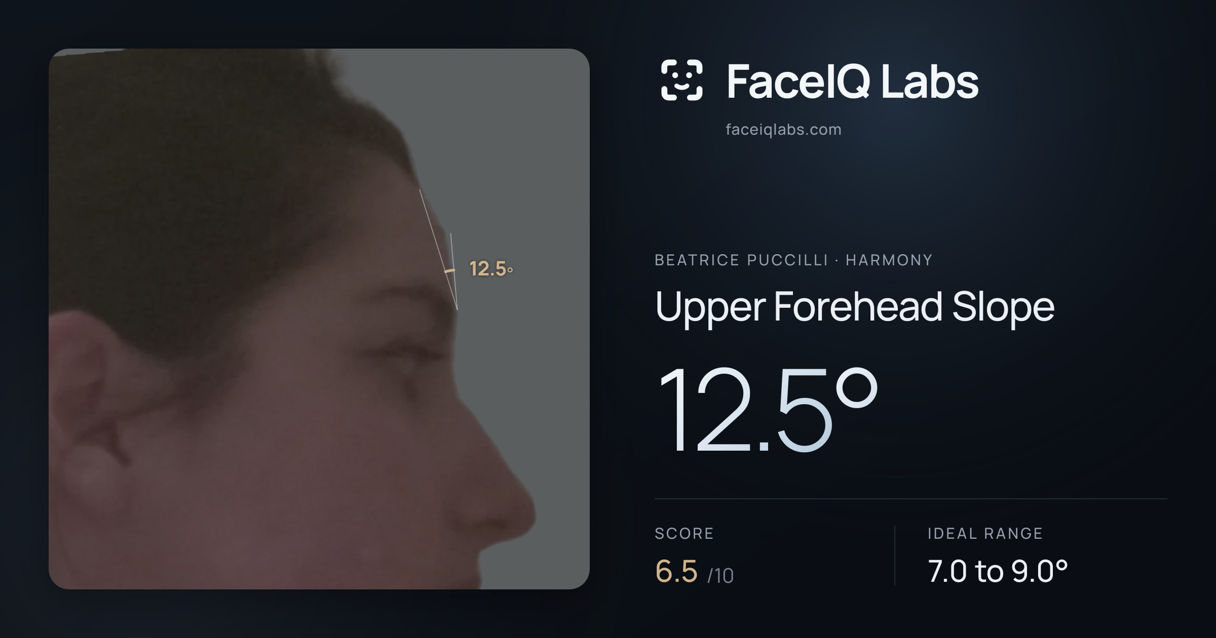 Beatrice Puccilli Upper Forehead Slope: 12.5°, drawn on the photo