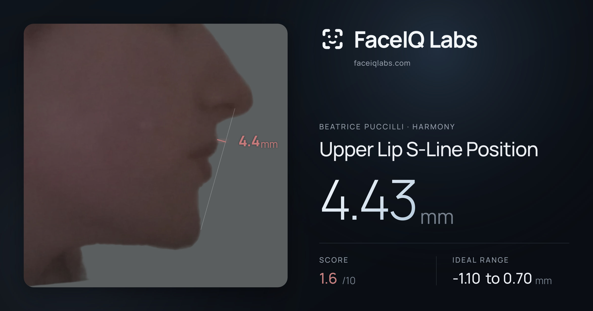 Beatrice Puccilli Upper Lip S-Line Position: 4.43mm, drawn on the photo