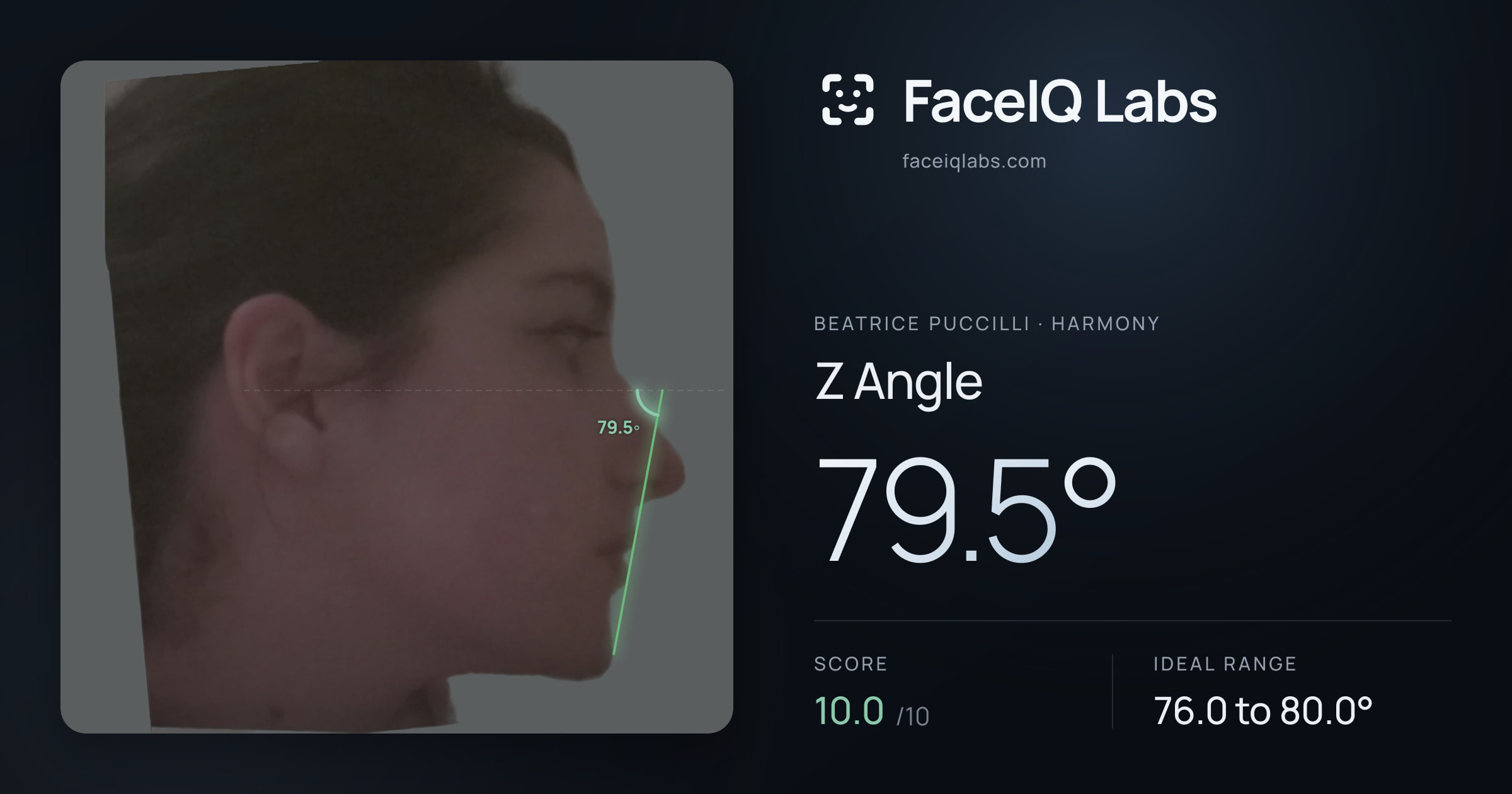 Beatrice Puccilli Z Angle: 79.5°, drawn on the photo