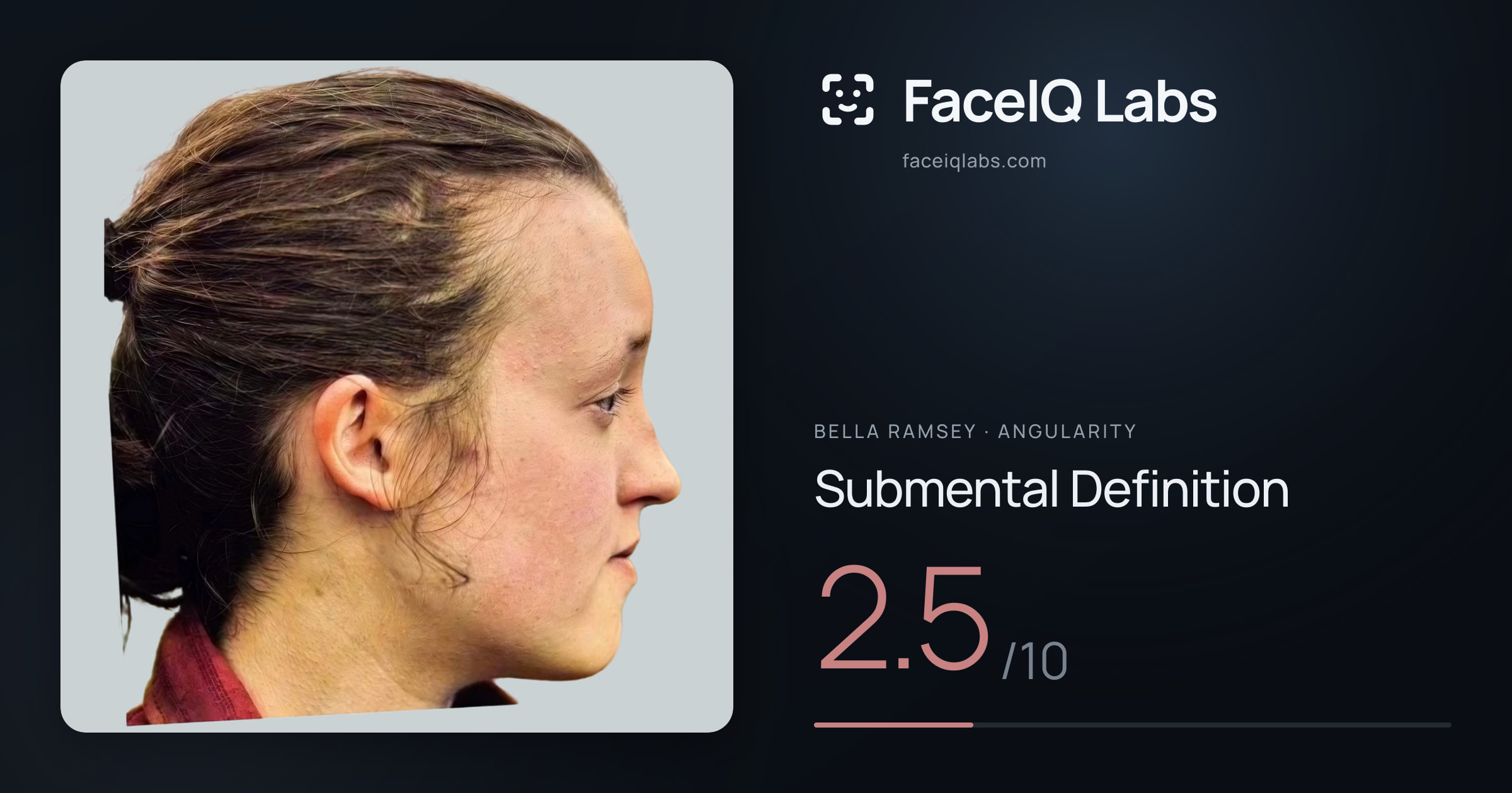 Bella Ramsey Submental Definition: 2.5/10, drawn on the photo