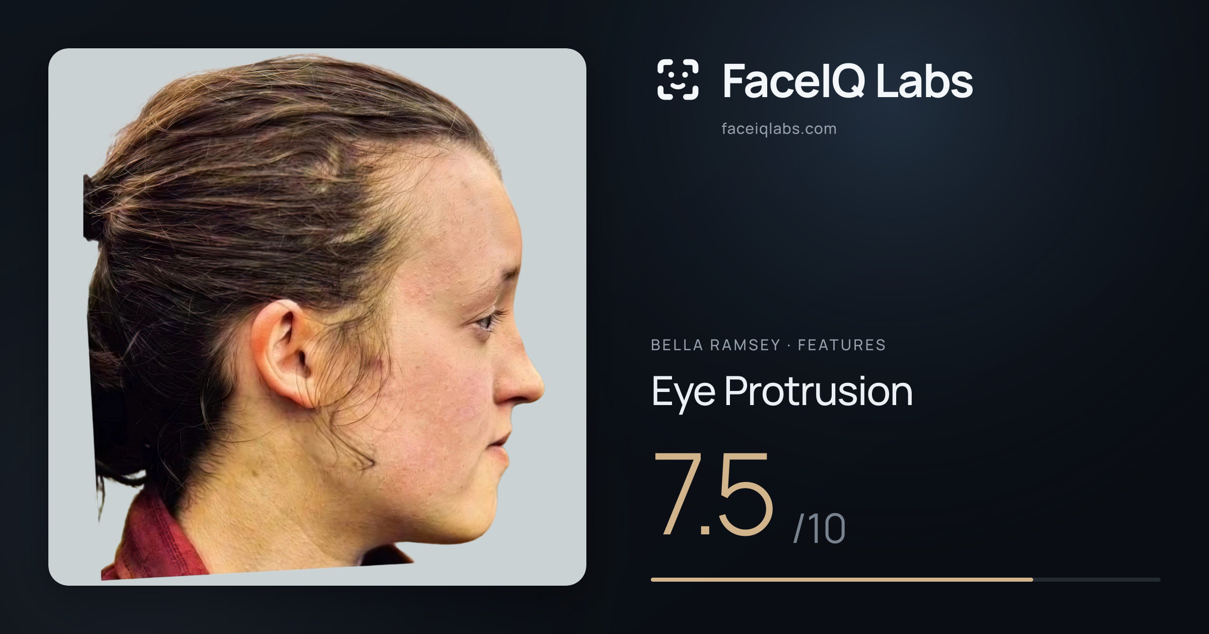Bella Ramsey Eye Protrusion: 7.5/10, drawn on the photo