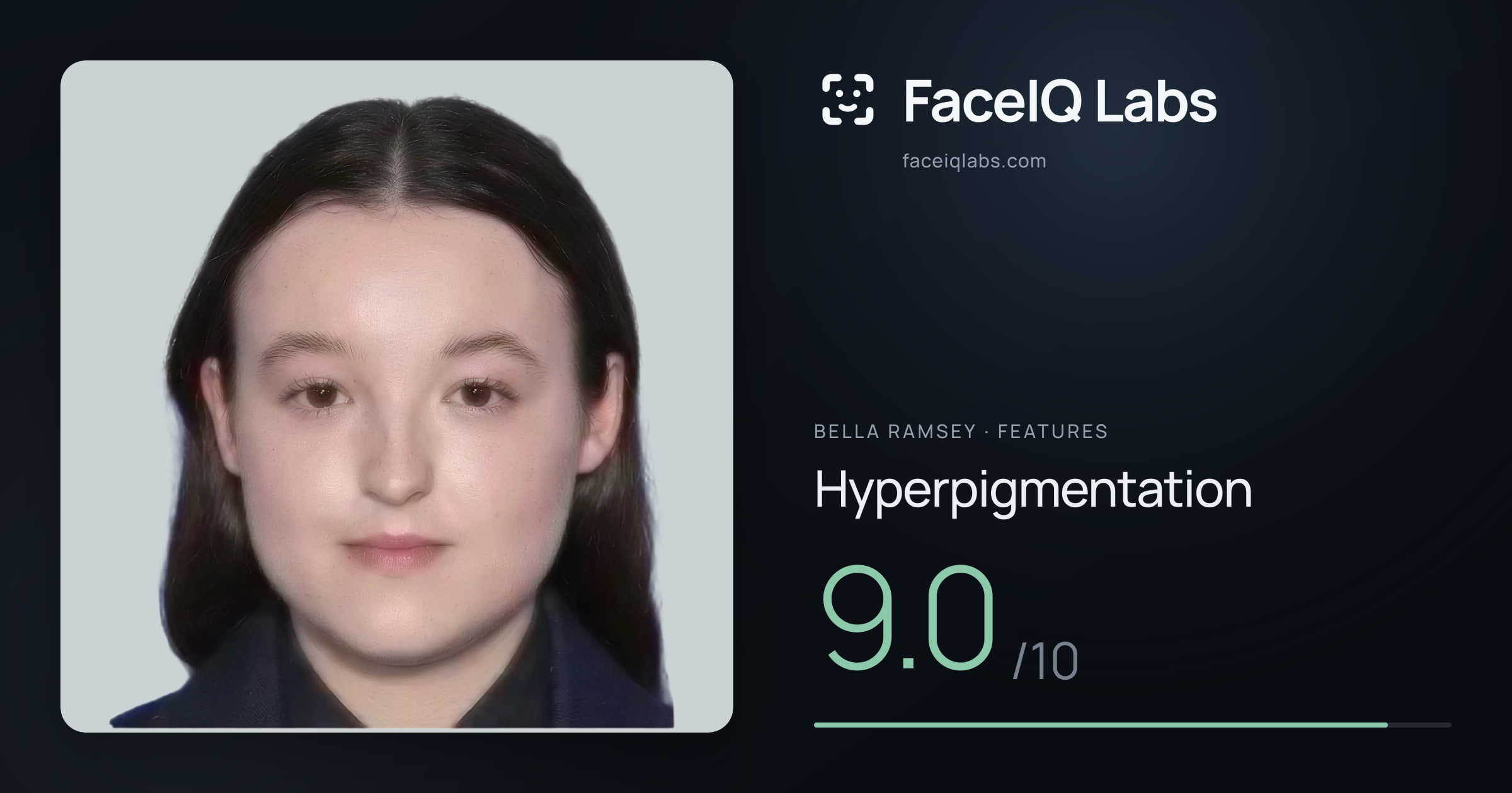 Bella Ramsey Hyperpigmentation: 9.0/10, drawn on the photo