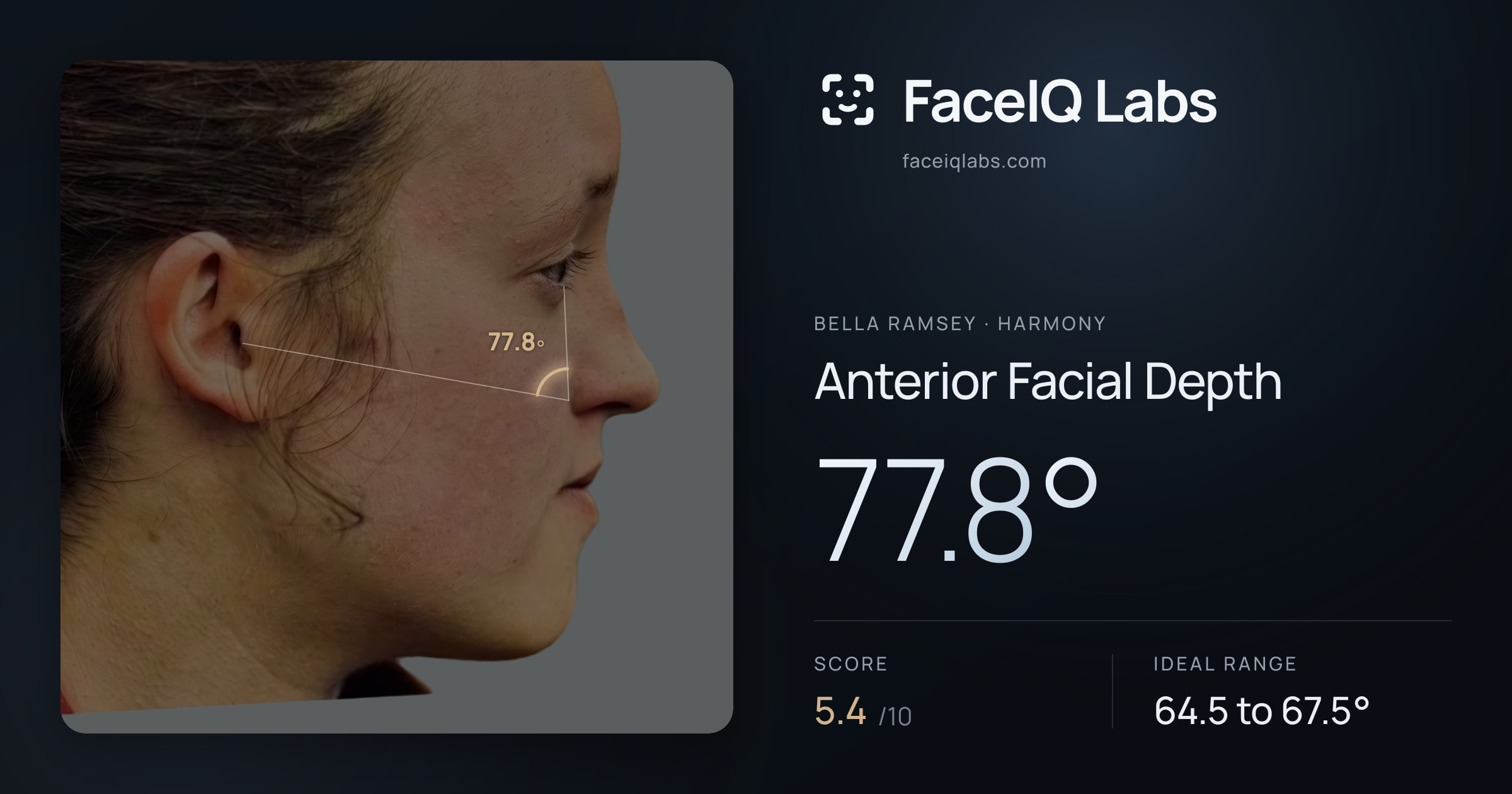Bella Ramsey Anterior Facial Depth: 77.8°, drawn on the photo