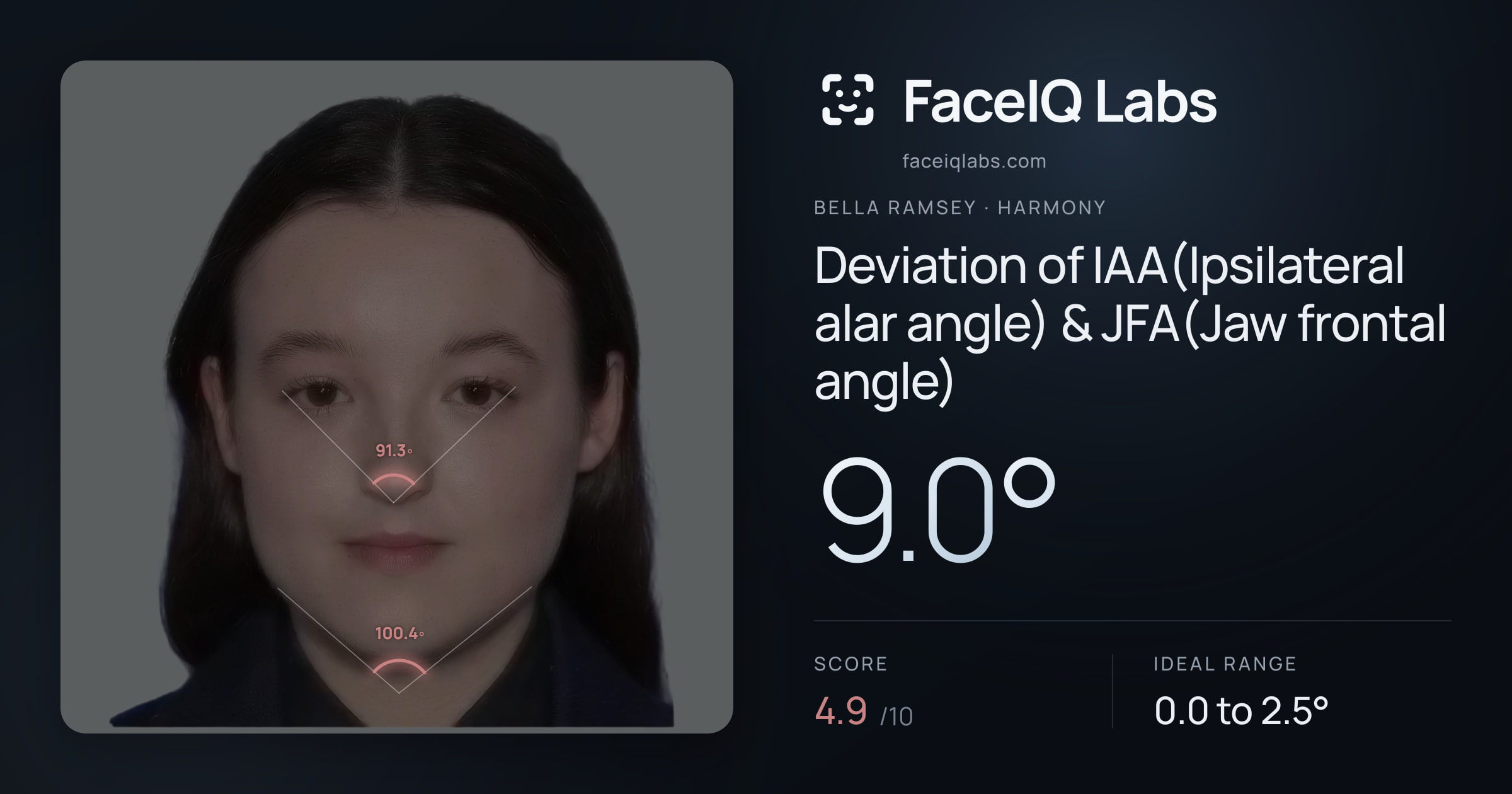 Bella Ramsey Deviation of IAA(Ipsilateral alar angle) & JFA(Jaw frontal angle): 9.0°, drawn on the photo