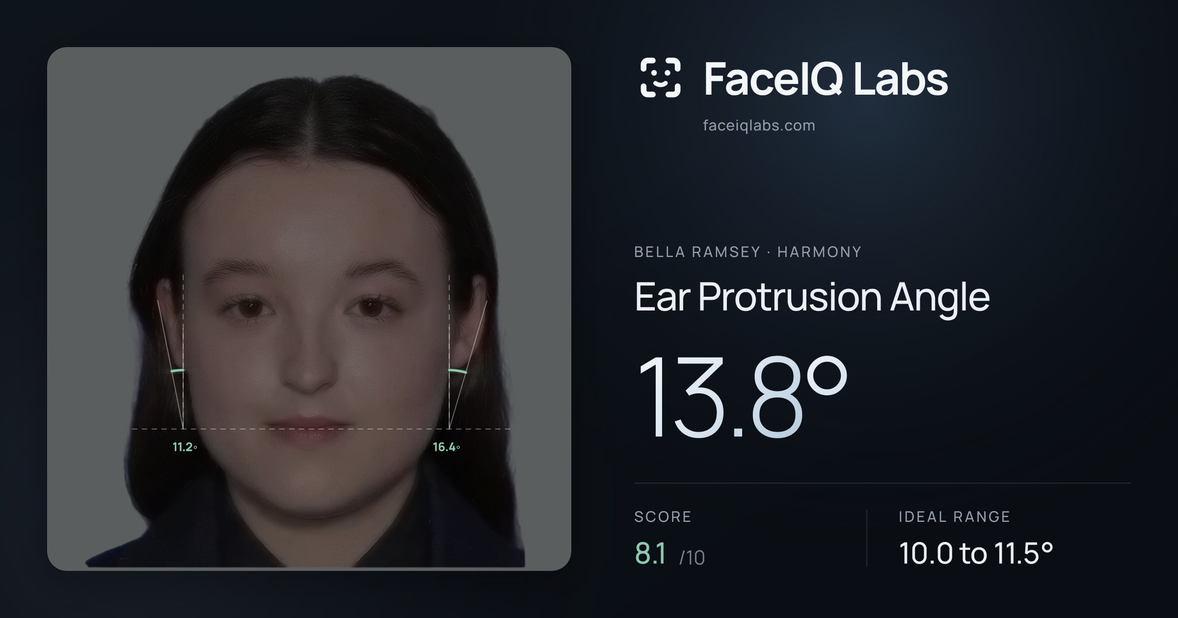 Bella Ramsey Ear Protrusion Angle: 13.8°, drawn on the photo
