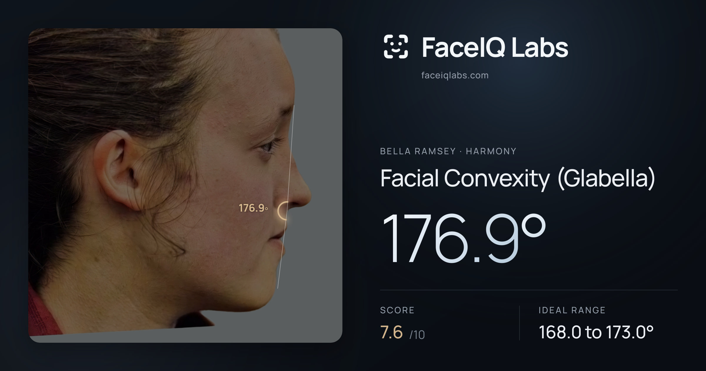 Bella Ramsey Facial Convexity (Glabella): 176.9°, drawn on the photo