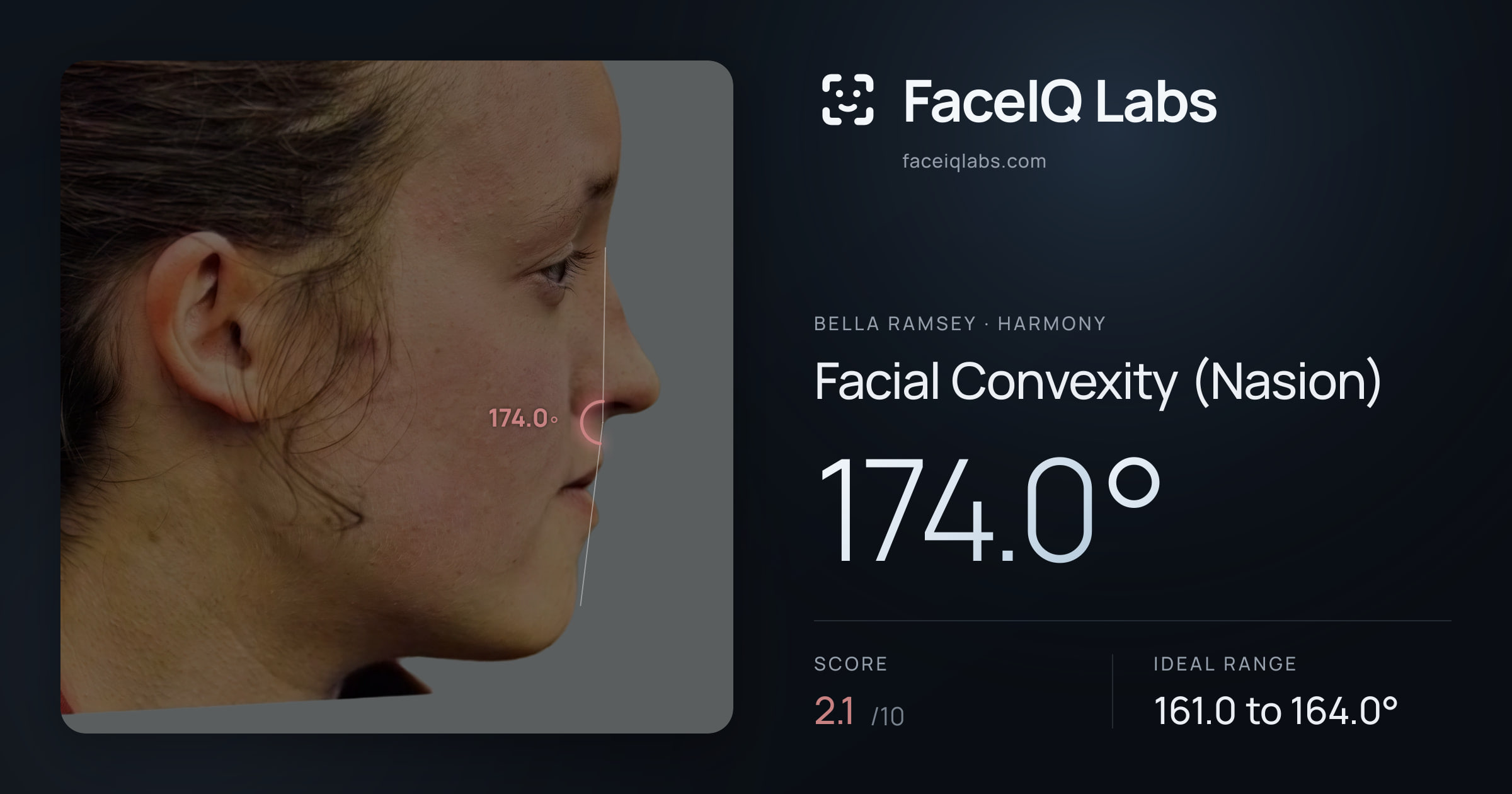 Bella Ramsey Facial Convexity (Nasion): 174.0°, drawn on the photo
