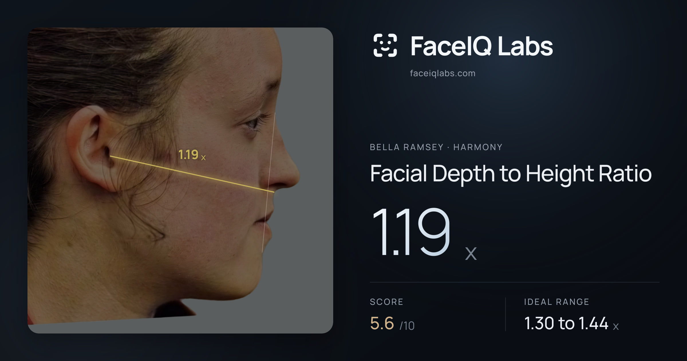 Bella Ramsey Facial Depth to Height Ratio: 1.19x, drawn on the photo