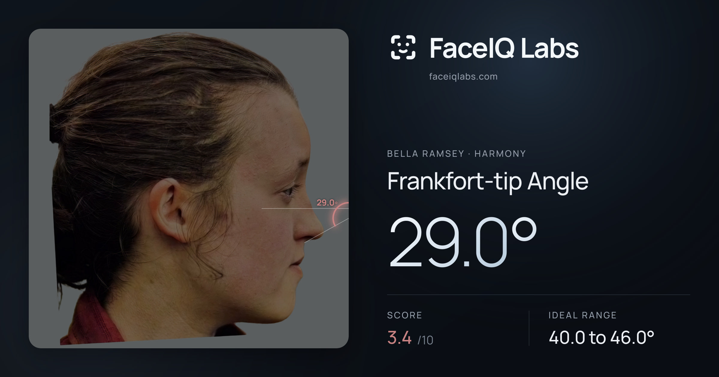 Bella Ramsey Frankfort-tip Angle: 29.0°, drawn on the photo
