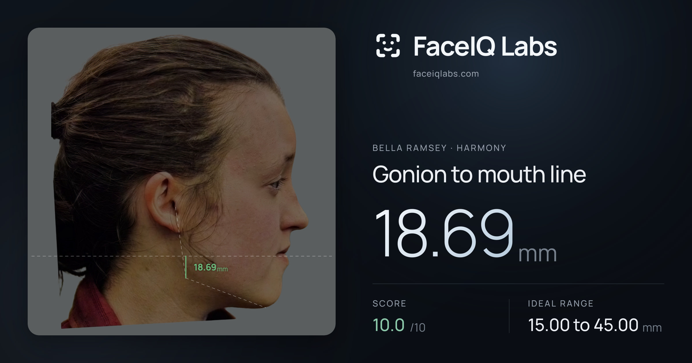 Bella Ramsey Gonion to mouth line: 18.69mm, drawn on the photo