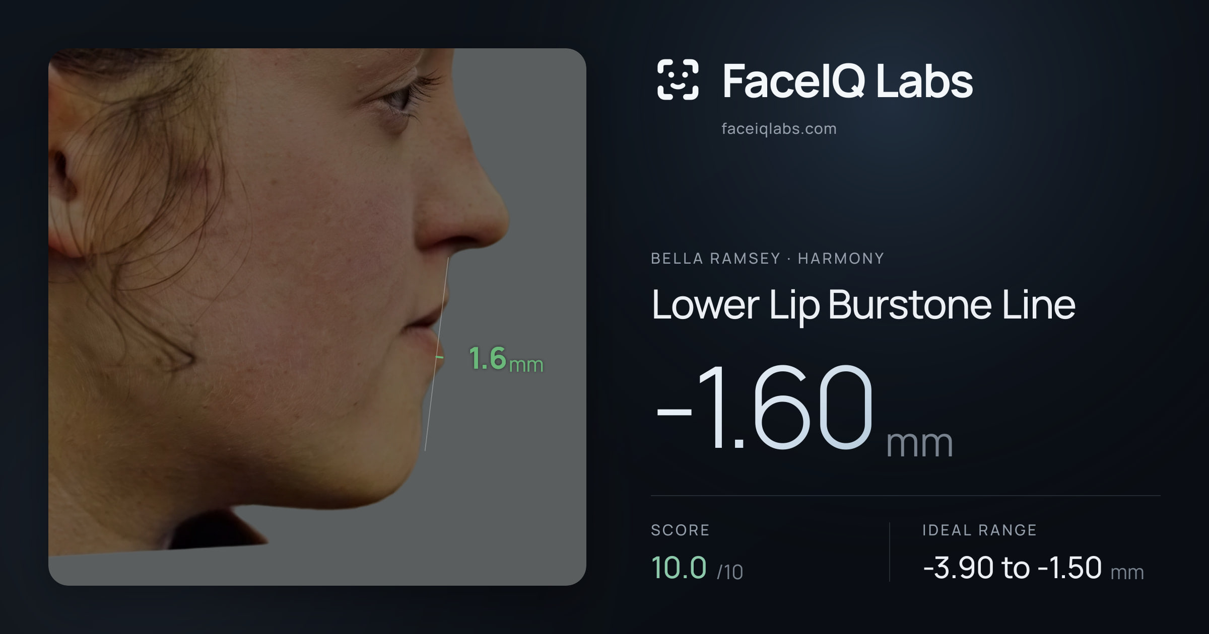Bella Ramsey Lower Lip Burstone Line: -1.60mm, drawn on the photo