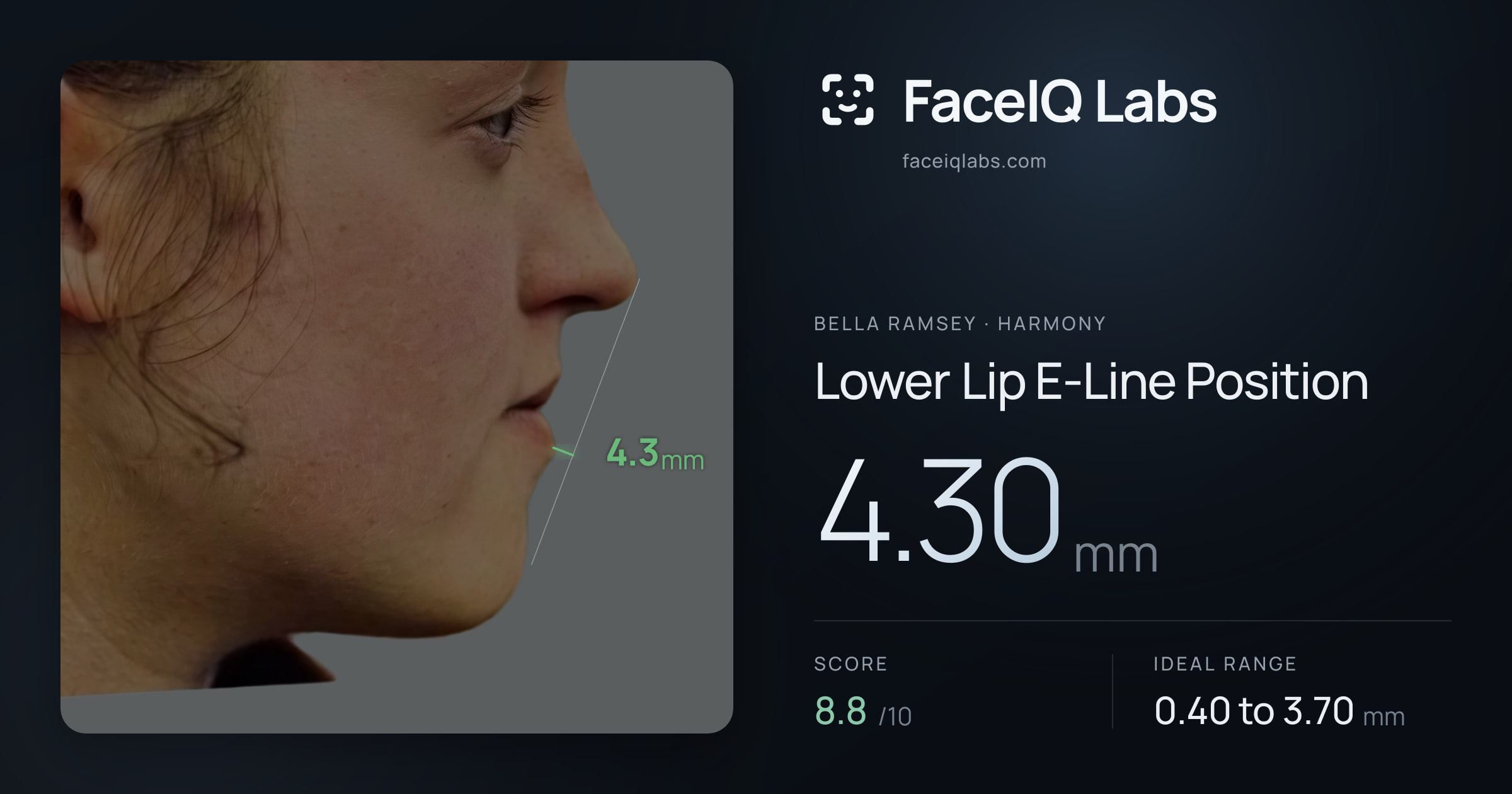 Bella Ramsey Lower Lip E-Line Position: 4.30mm, drawn on the photo