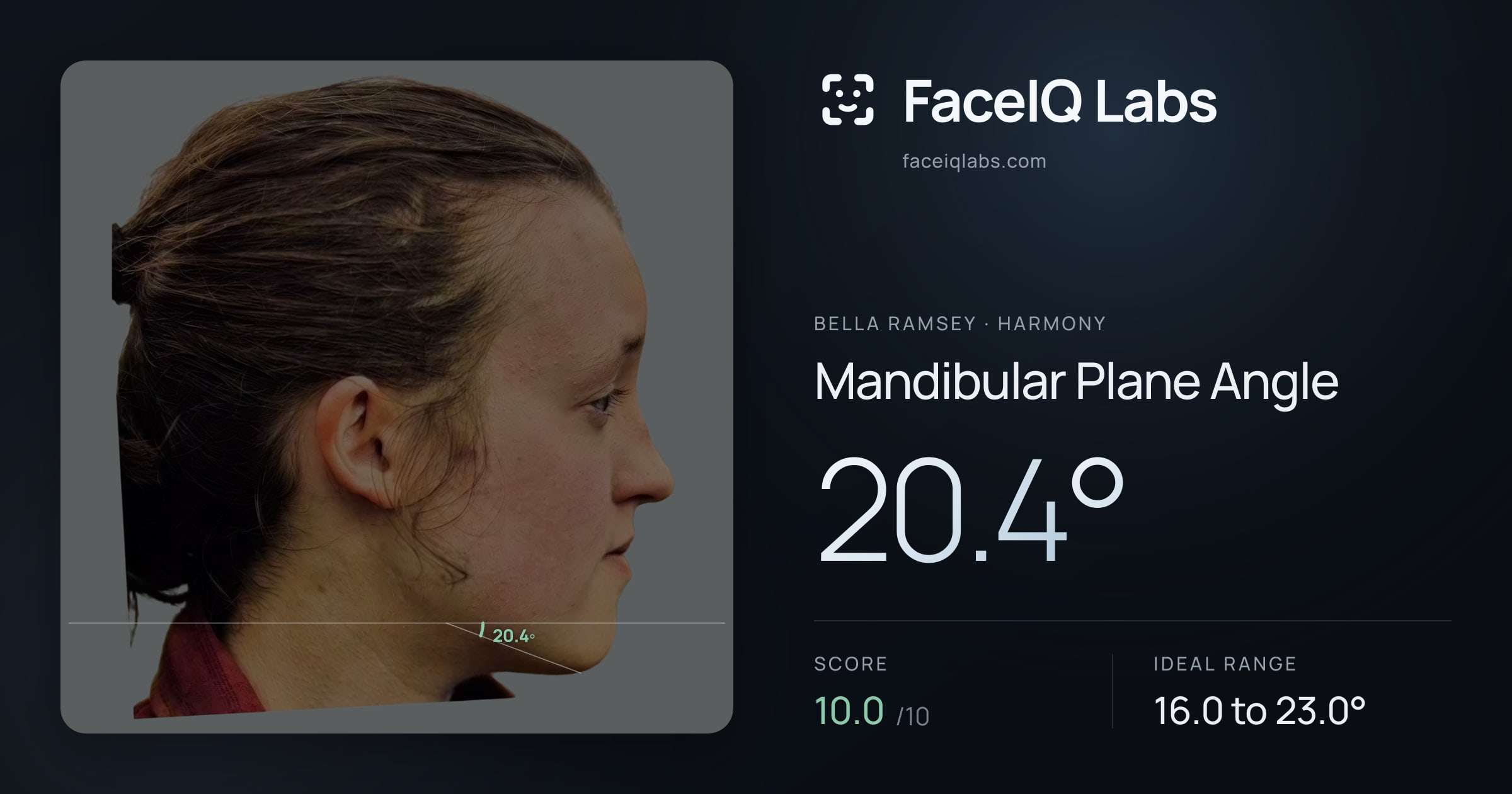 Bella Ramsey Mandibular Plane Angle: 20.4°, drawn on the photo