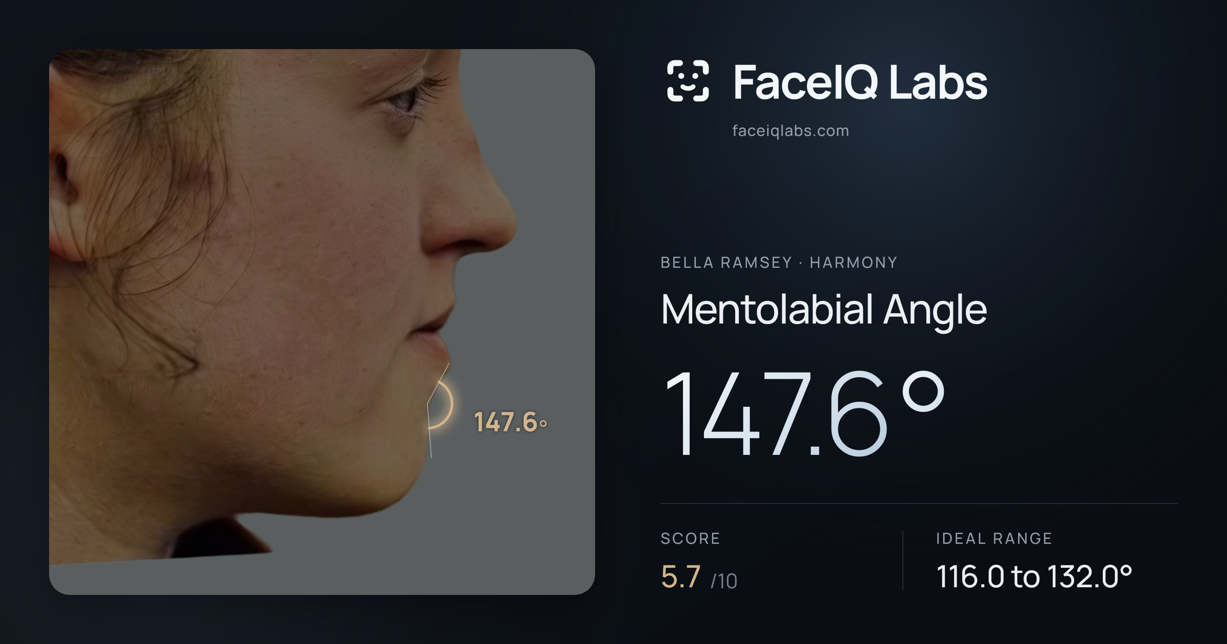 Bella Ramsey Mentolabial Angle: 147.6°, drawn on the photo