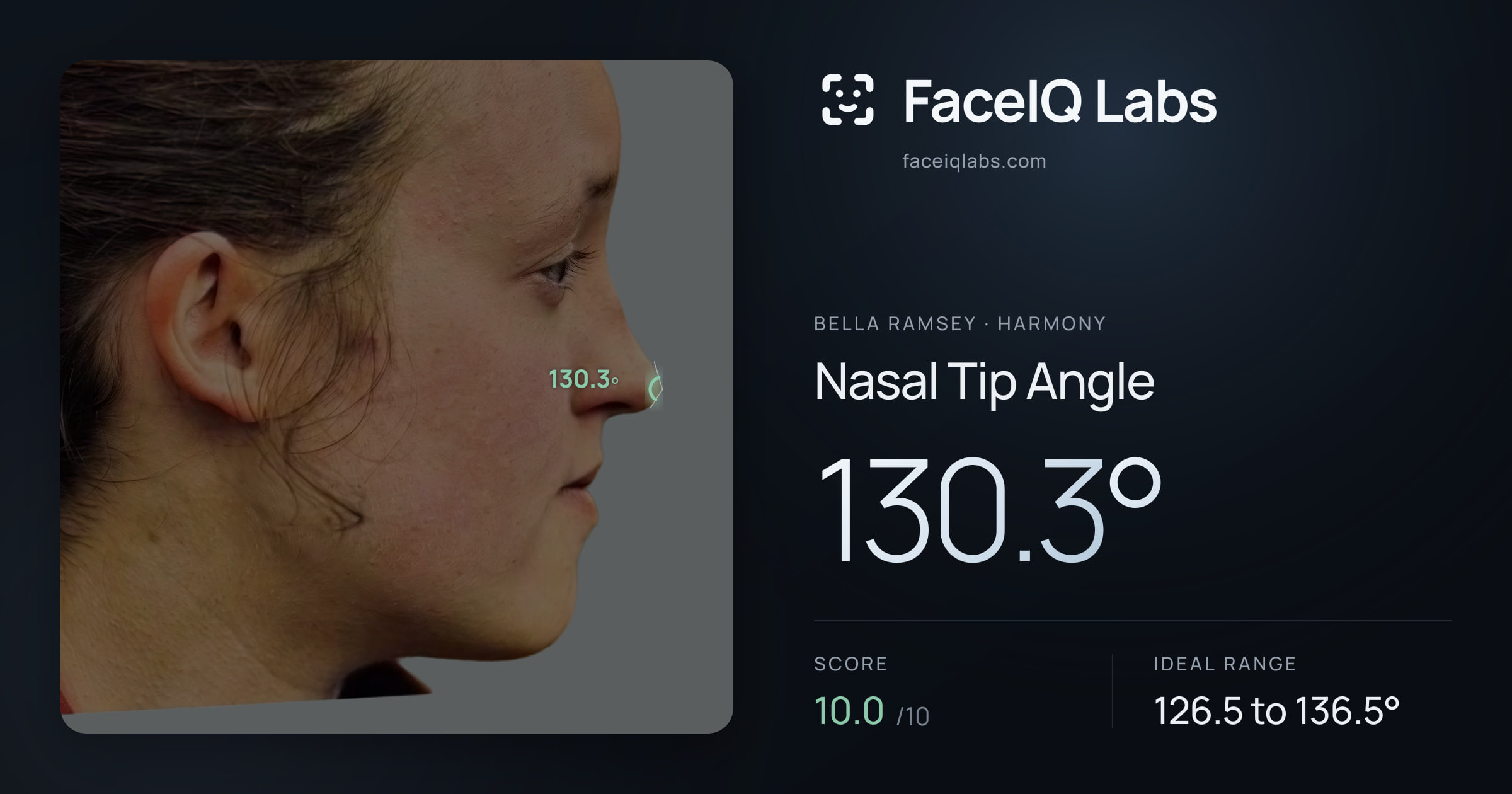 Bella Ramsey Nasal Tip Angle: 130.3°, drawn on the photo