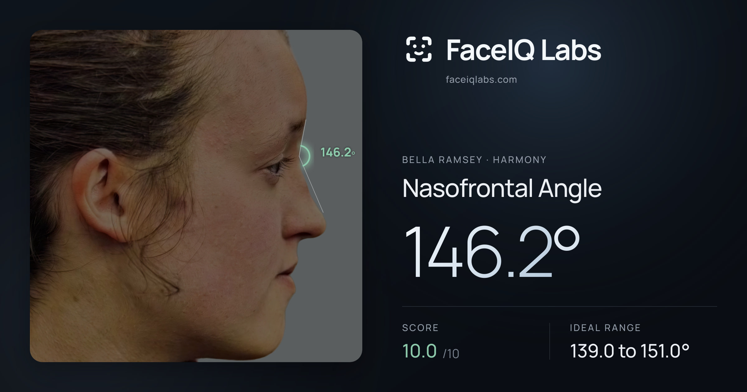 Bella Ramsey Nasofrontal Angle: 146.2°, drawn on the photo