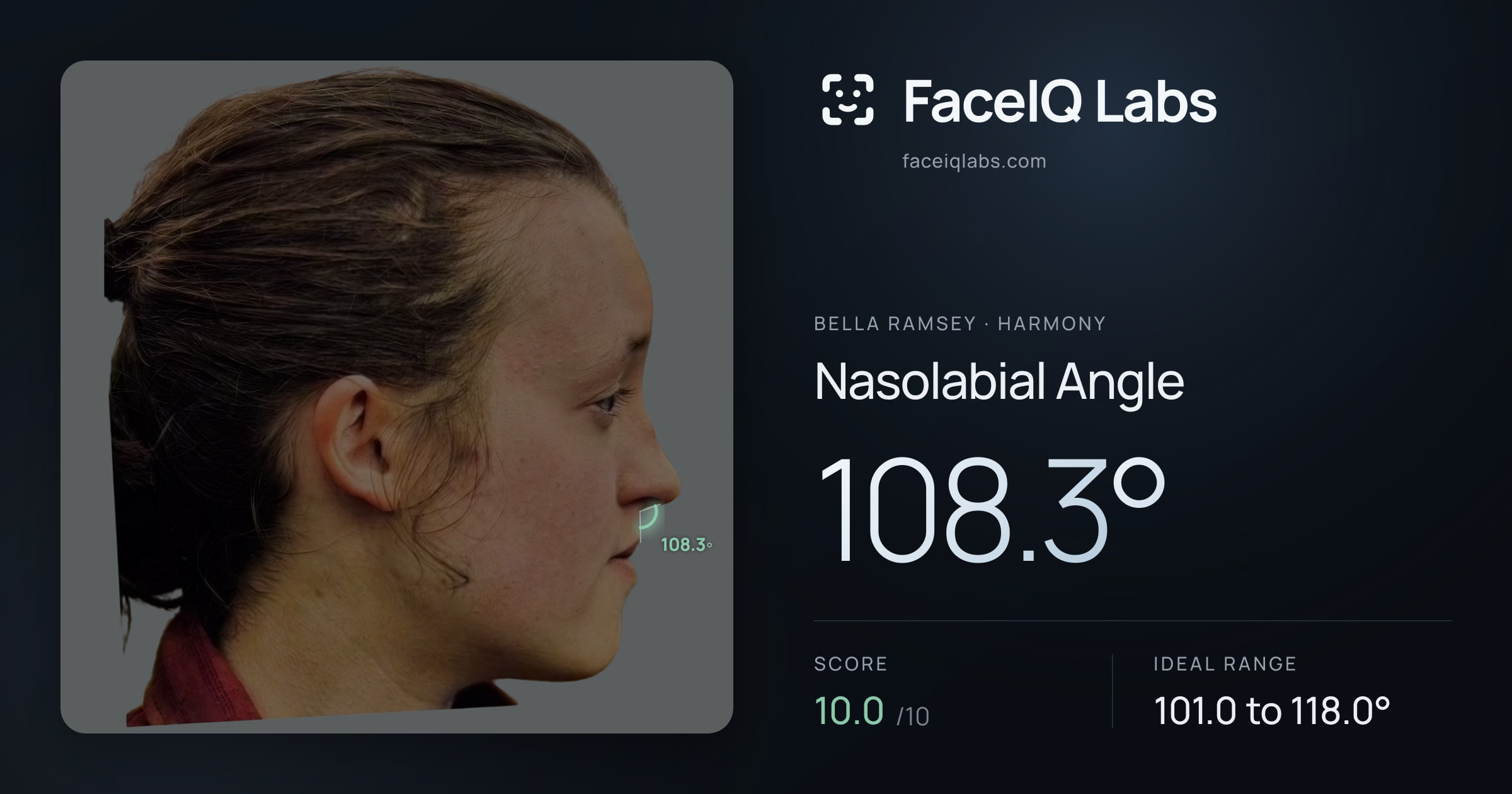 Bella Ramsey Nasolabial Angle: 108.3°, drawn on the photo