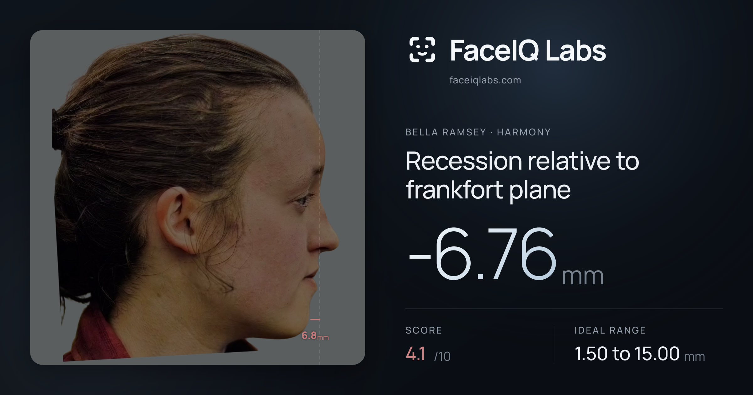 Bella Ramsey Recession relative to frankfort plane: -6.76mm, drawn on the photo