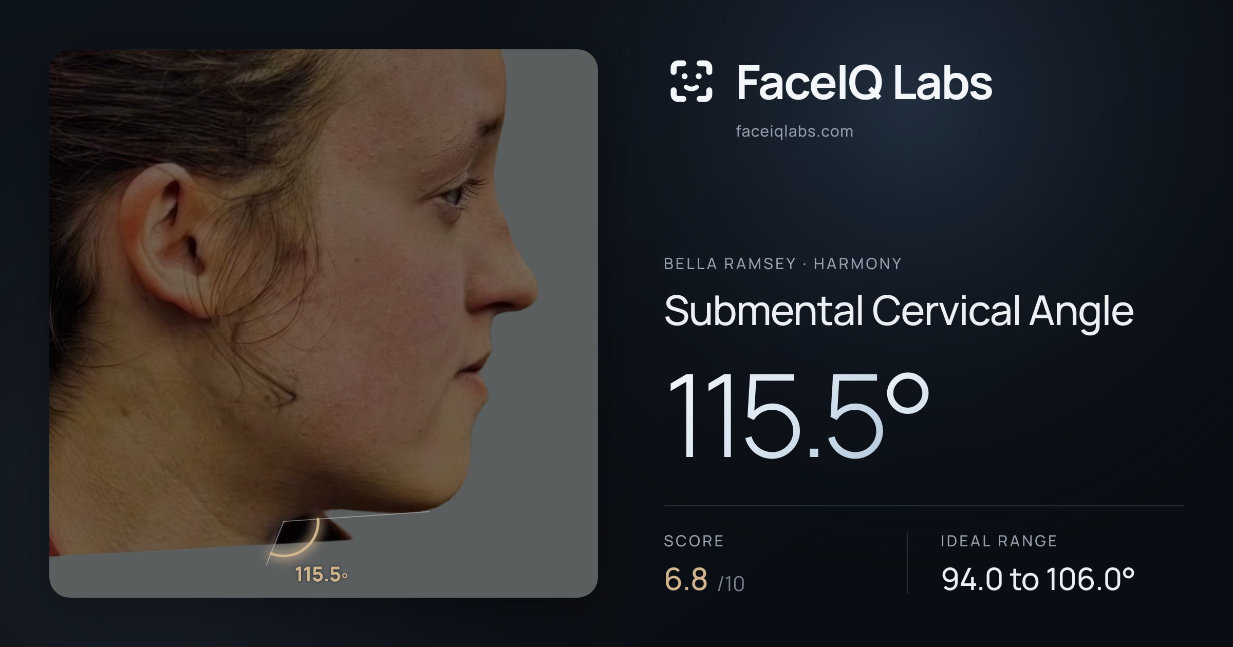Bella Ramsey Submental Cervical Angle: 115.5°, drawn on the photo