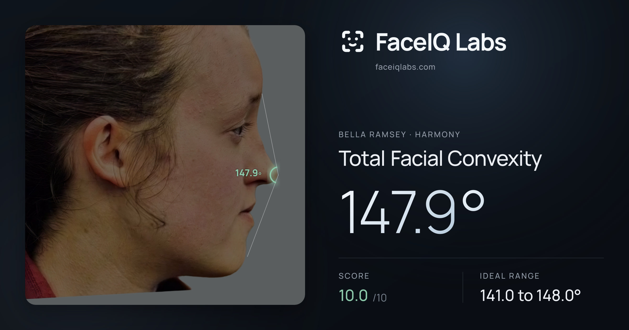 Bella Ramsey Total Facial Convexity: 147.9°, drawn on the photo