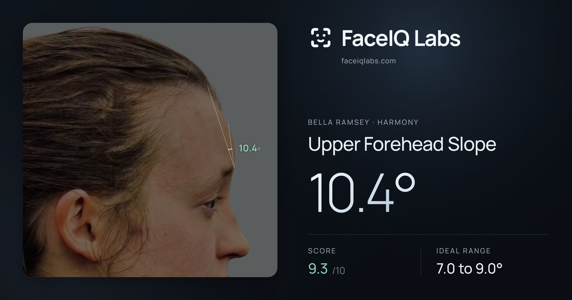 Bella Ramsey Upper Forehead Slope: 10.4°, drawn on the photo