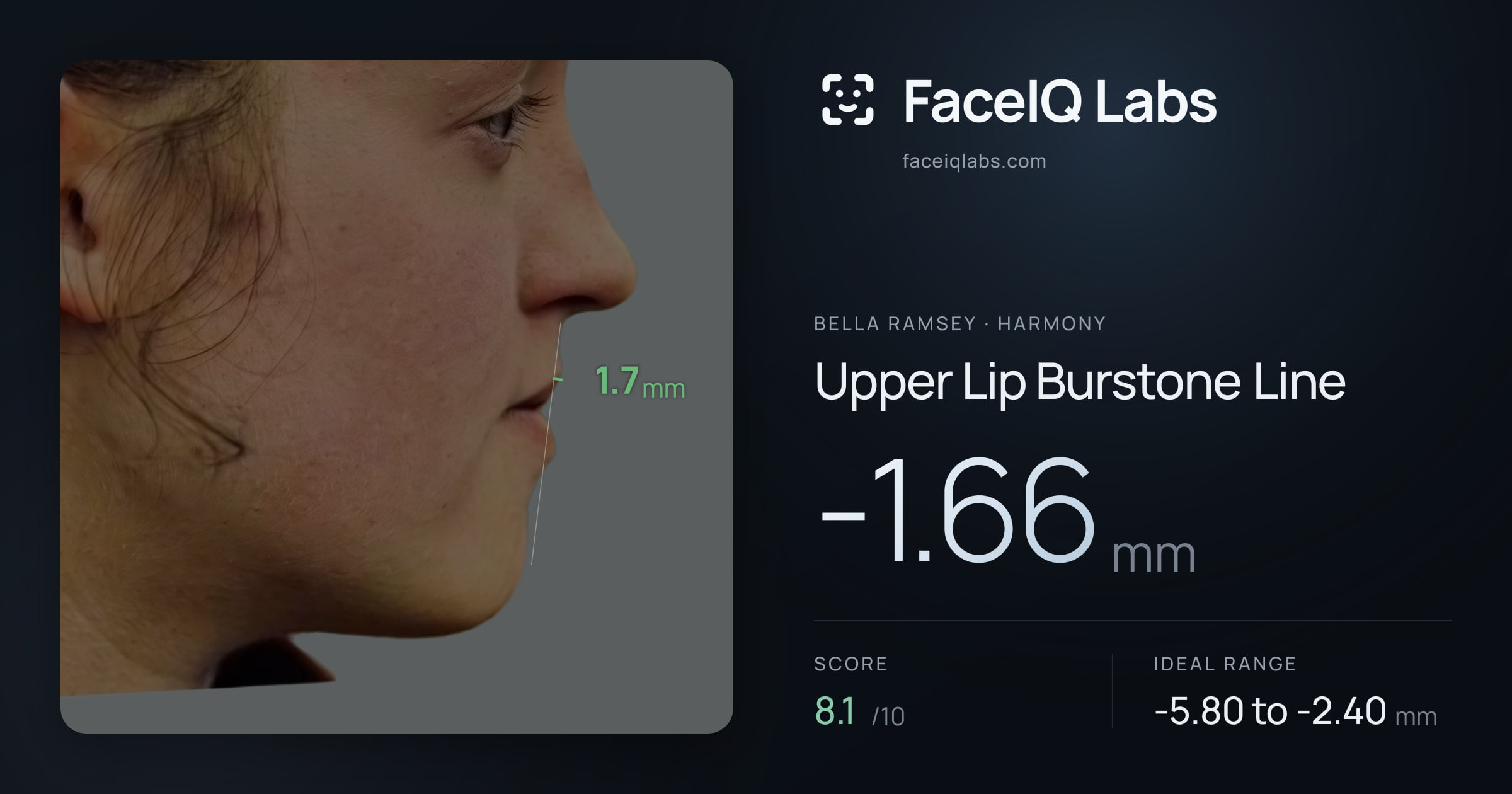 Bella Ramsey Upper Lip Burstone Line: -1.66mm, drawn on the photo
