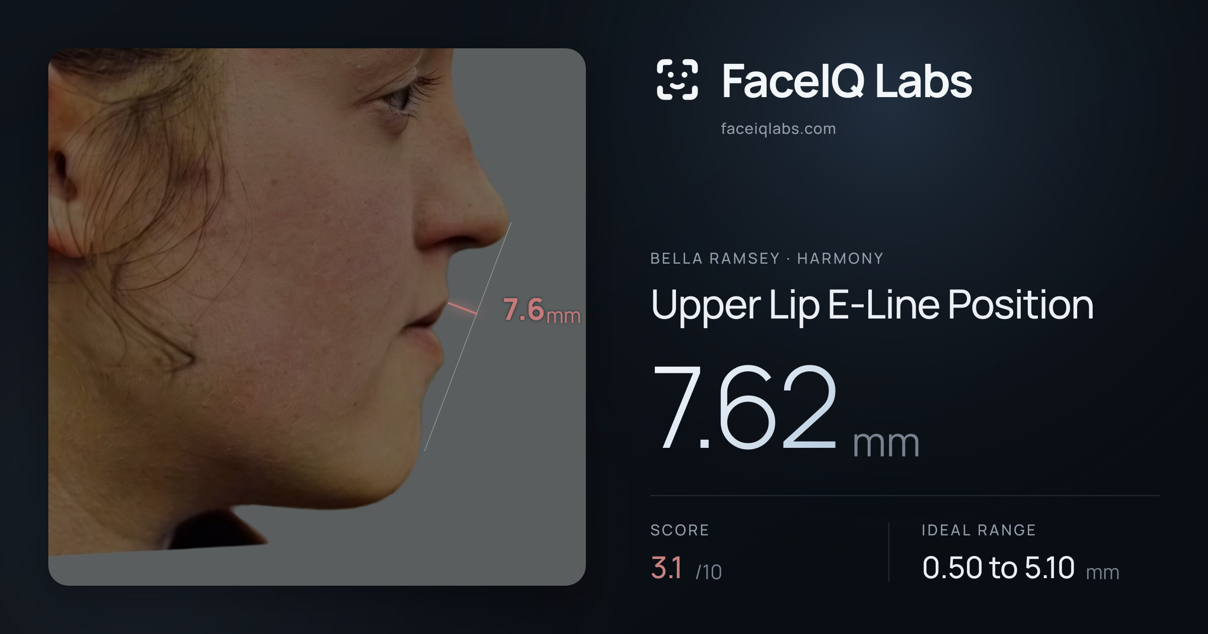Bella Ramsey Upper Lip E-Line Position: 7.62mm, drawn on the photo