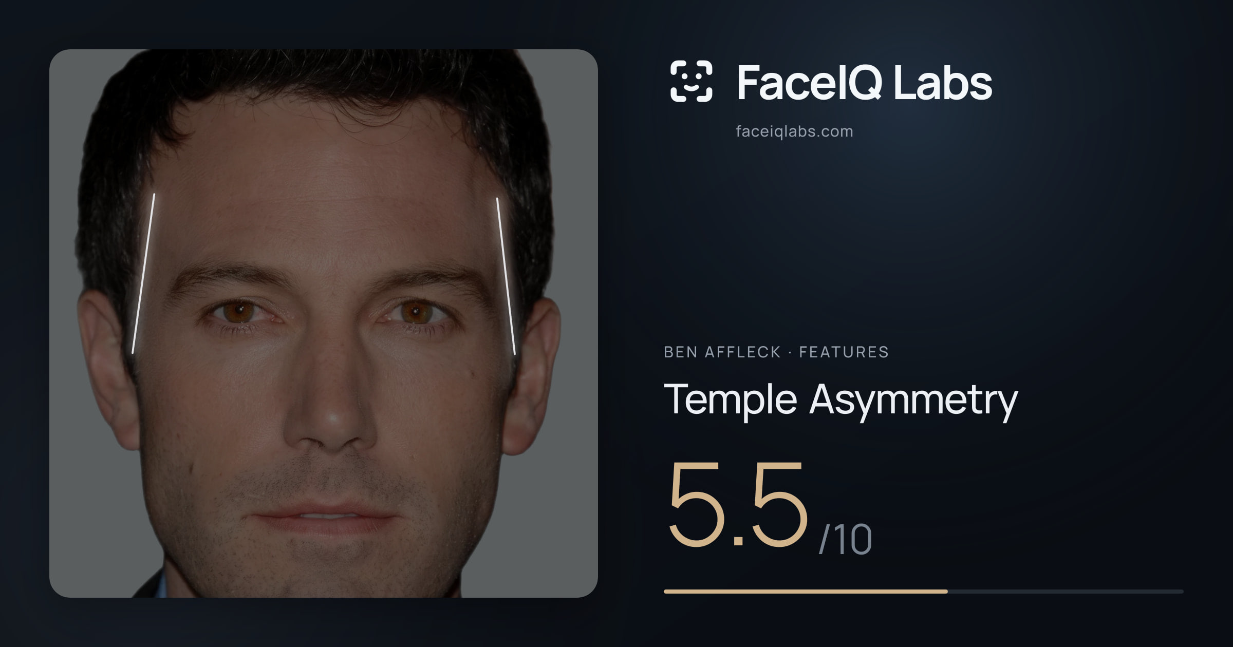 Ben Affleck Temple Asymmetry: 5.5/10, drawn on the photo