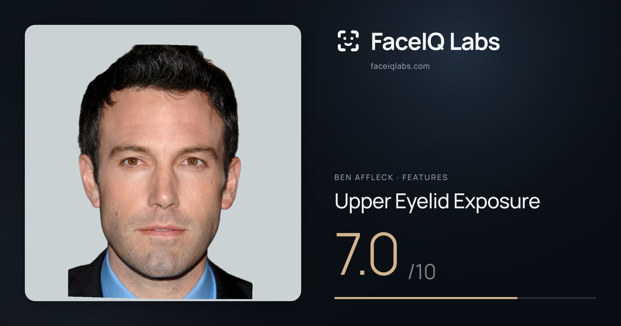 Ben Affleck Upper Eyelid Exposure: 7.0/10, drawn on the photo