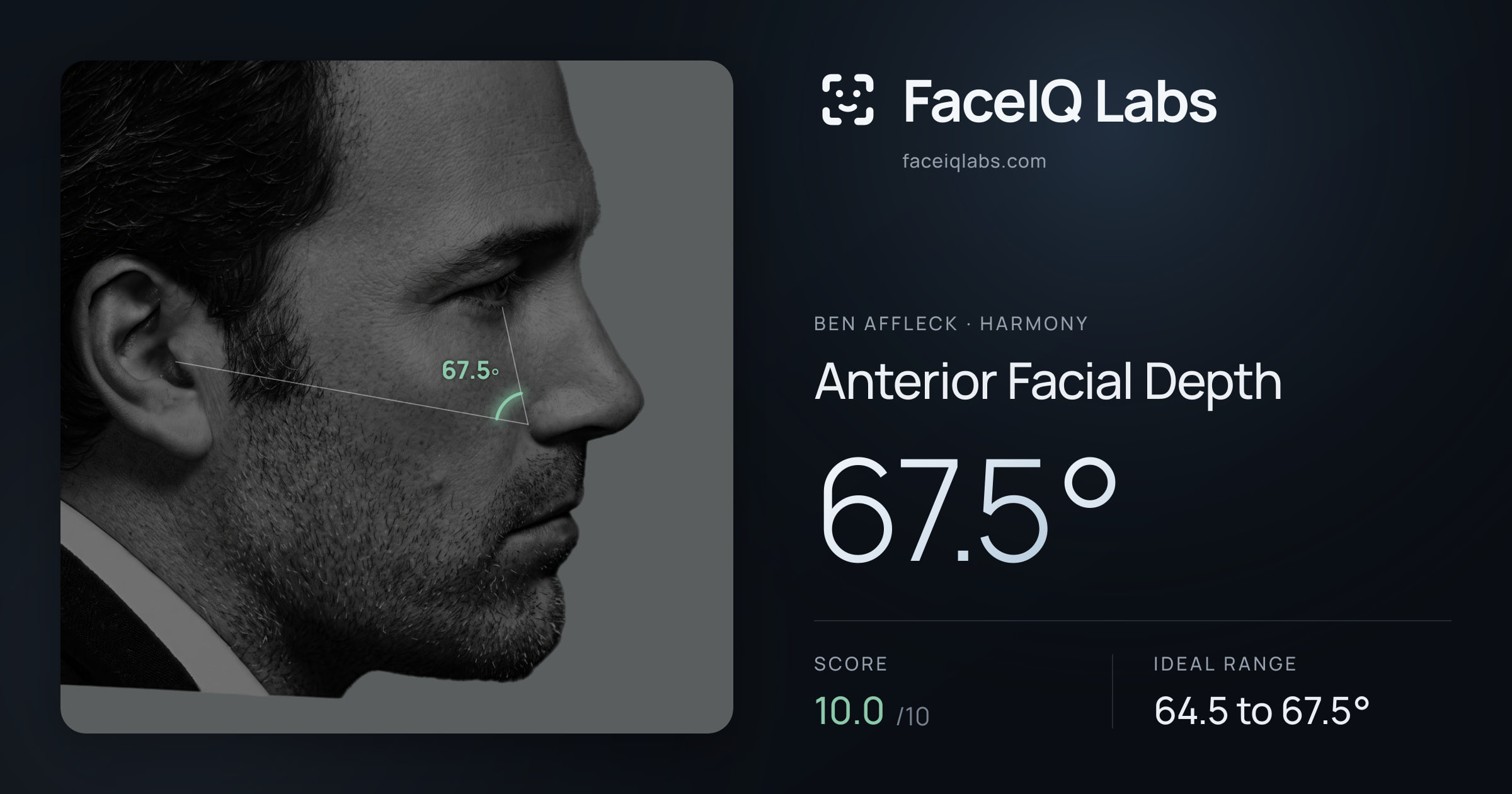 Ben Affleck Anterior Facial Depth: 67.5°, drawn on the photo