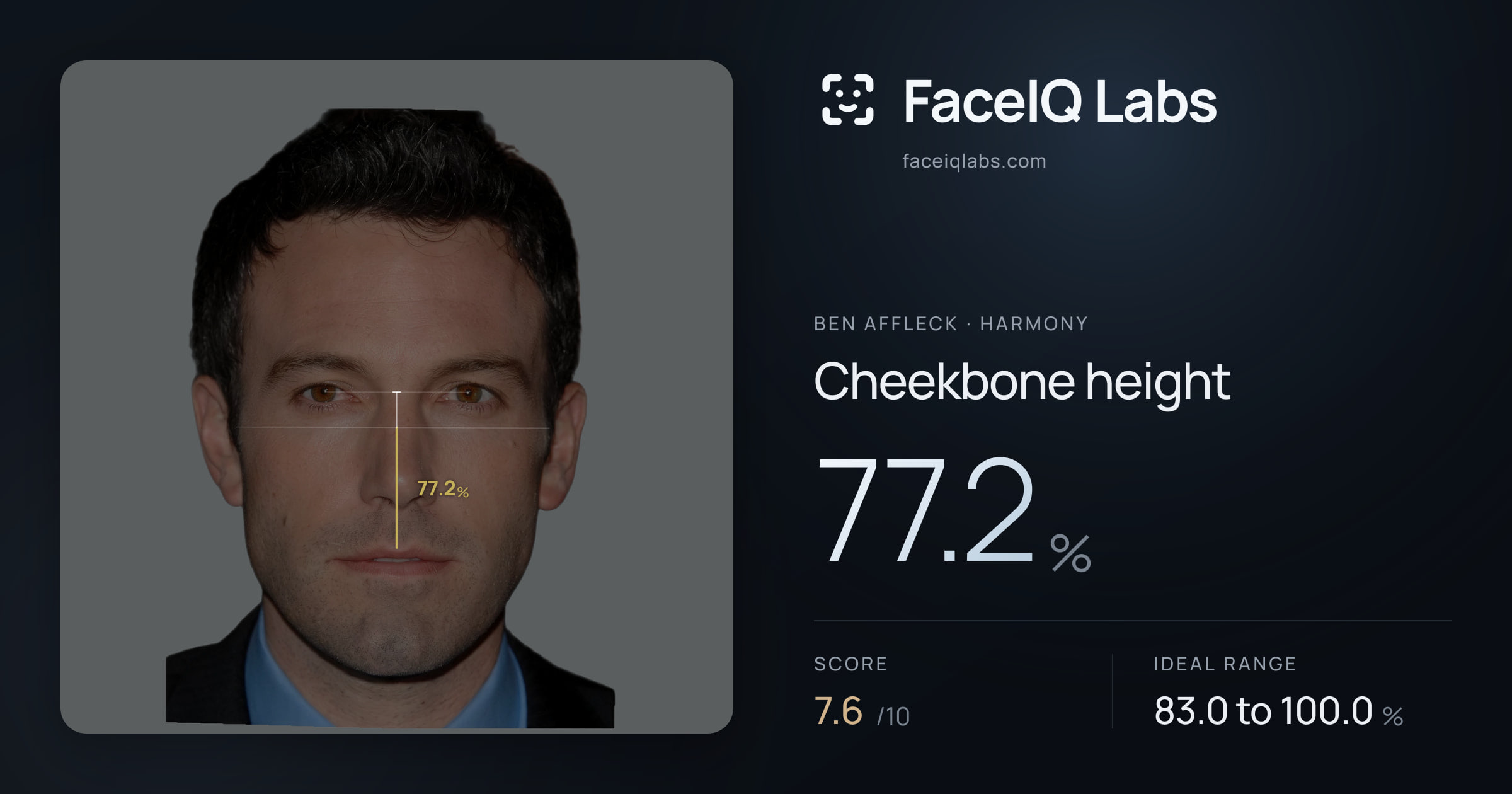 Ben Affleck Cheekbone height: 77.2%, drawn on the photo