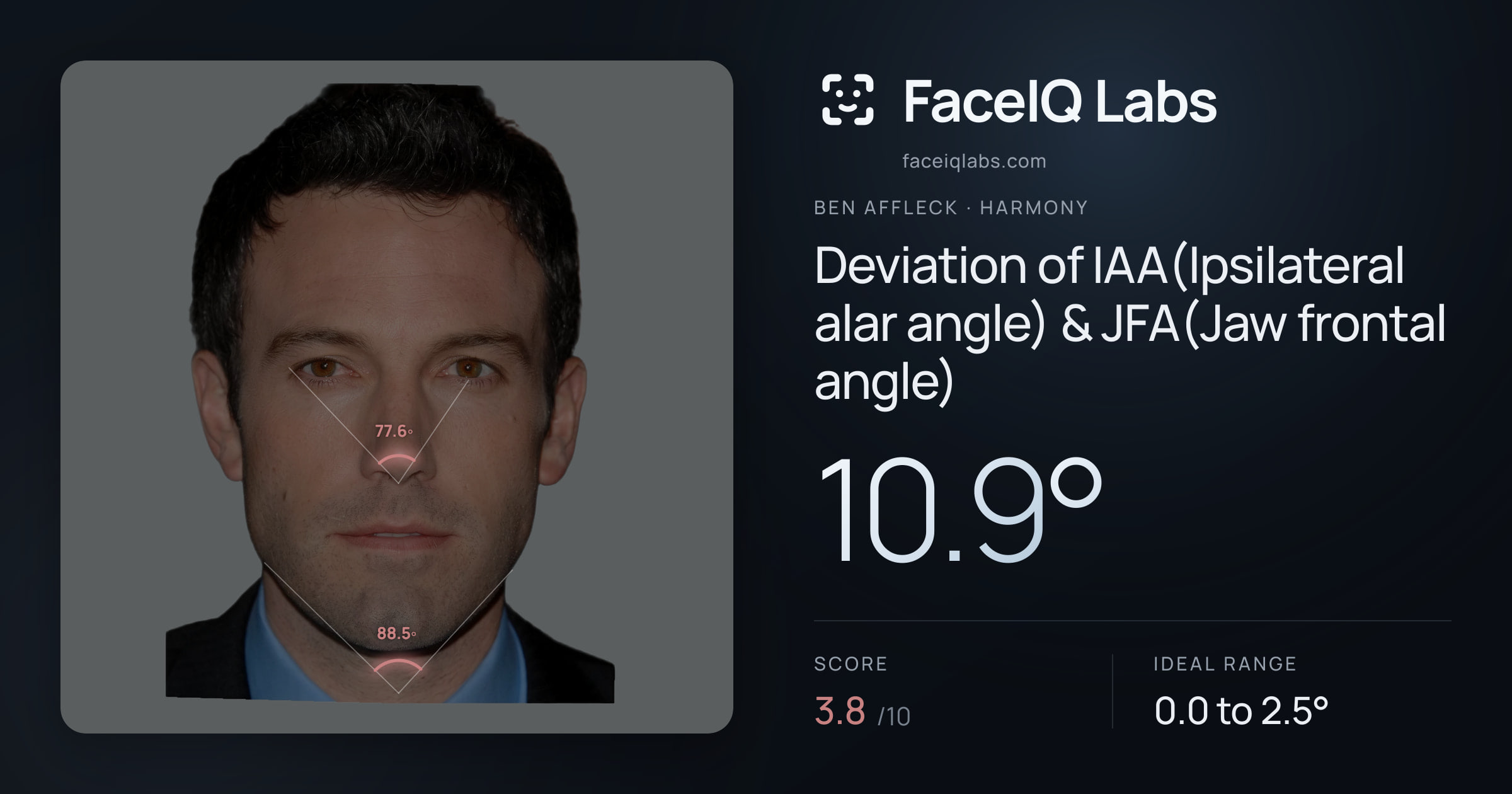 Ben Affleck Deviation of IAA(Ipsilateral alar angle) & JFA(Jaw frontal angle): 10.9°, drawn on the photo
