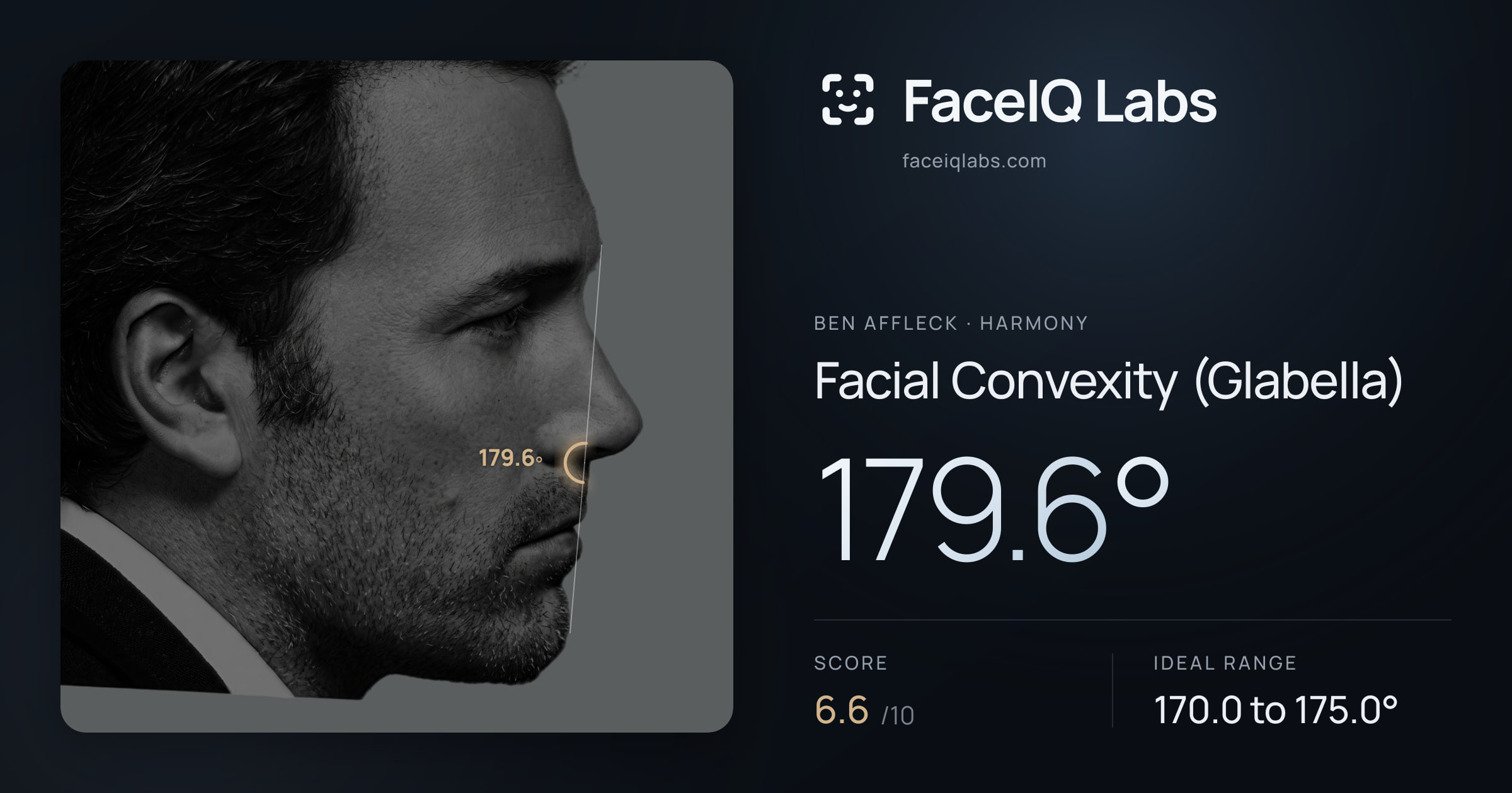 Ben Affleck Facial Convexity (Glabella): 179.6°, drawn on the photo
