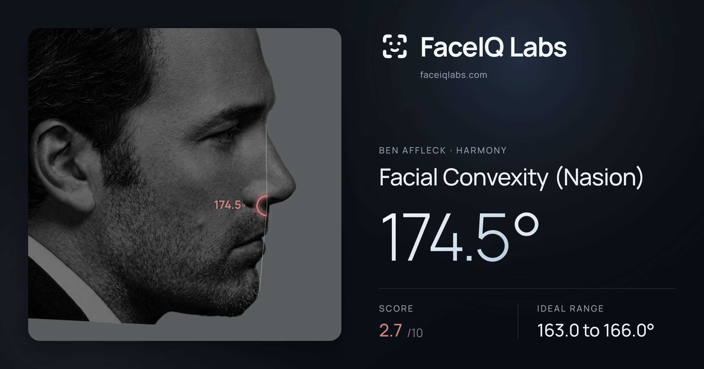 Ben Affleck Facial Convexity (Nasion): 174.5°, drawn on the photo