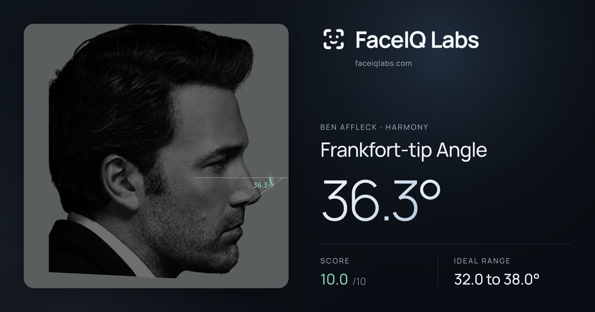 Ben Affleck Frankfort-tip Angle: 36.3°, drawn on the photo