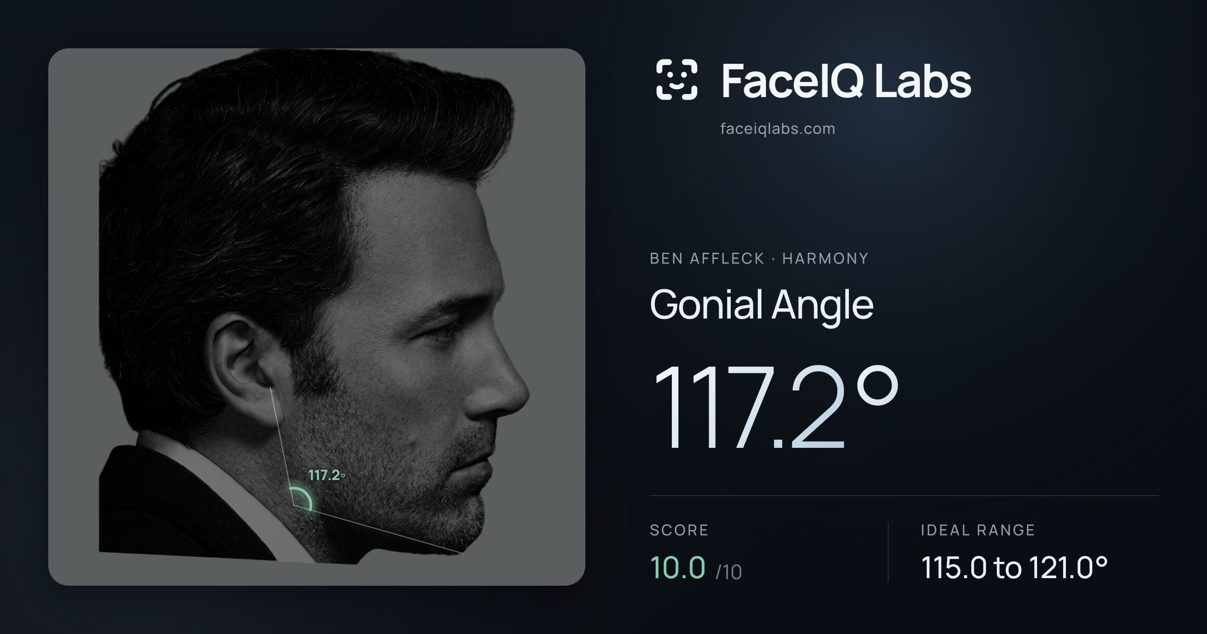 Ben Affleck Gonial Angle: 117.2°, drawn on the photo